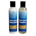 Itchy Scalp Shampoo & Conditioner Set, 8 oz Each, African Black Soap Shampoo, Dandruff shampoo & Conditioner, All-Natural Treatment, Dry & Itchy Scalp