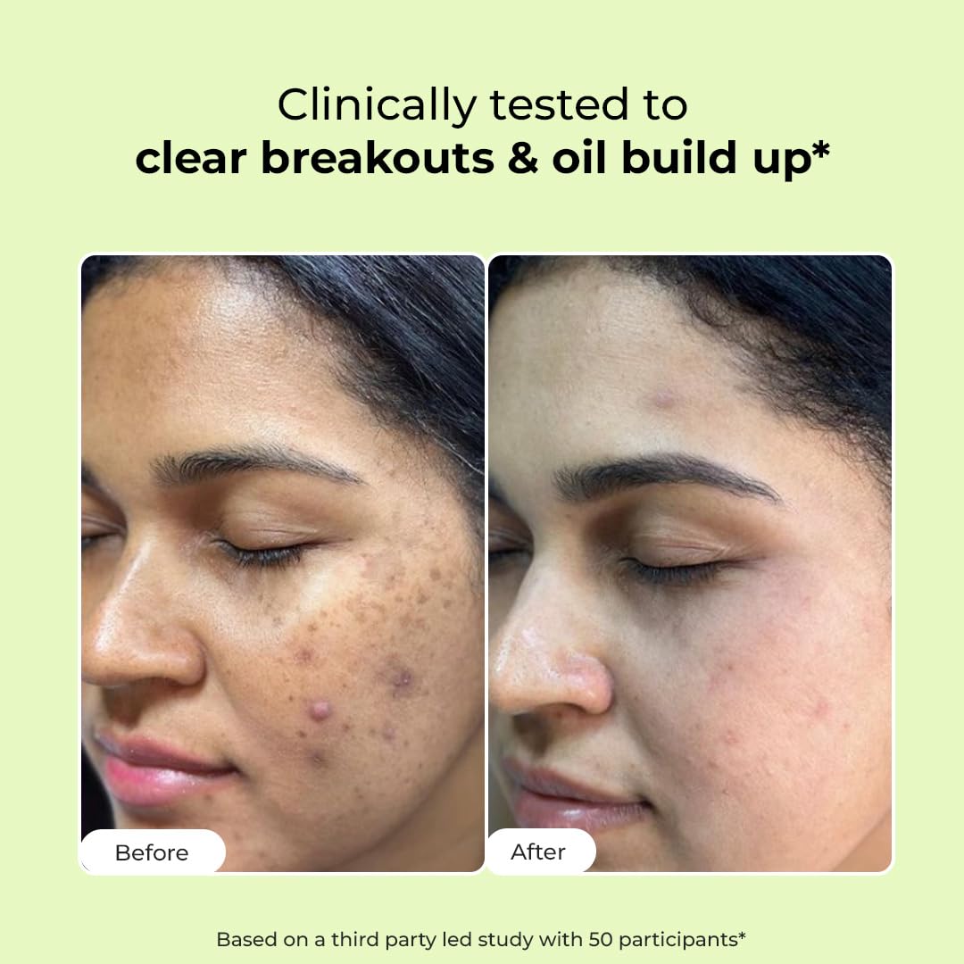 Conscious Chemist® 2% Salicylic Acid Face Wash | 100ml | Face Wash for Oily & Acne Prone Skin for Men & Women, Glycolic Acid & CICA Extract