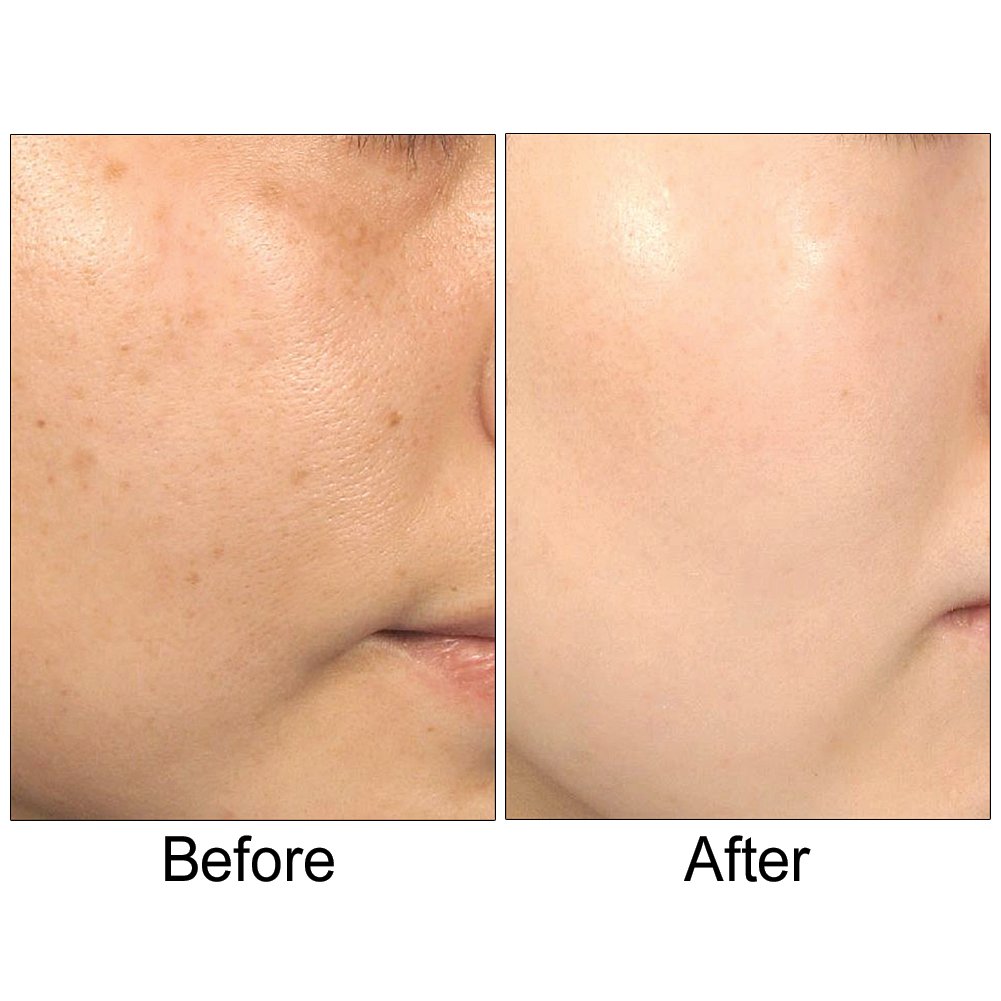 Lumetrics with Copuline by Biologic Solutions Diminishing Lines Wrinkles Radiant Skin Complex - 1 oz.
