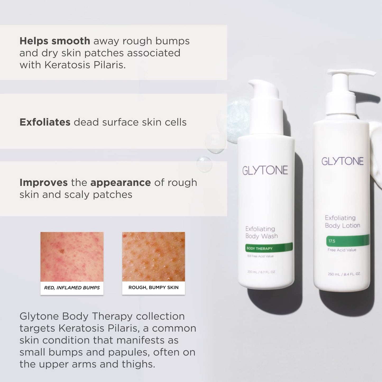 GLYTONE Glycolic Acid Body Wash - Exfoliating & Moisturizing Body Wash for Dry Skin, Reduce Keratosis Pilaris - Fragrance-Free Exfoliator Beauty & Personal Care GLYTONE