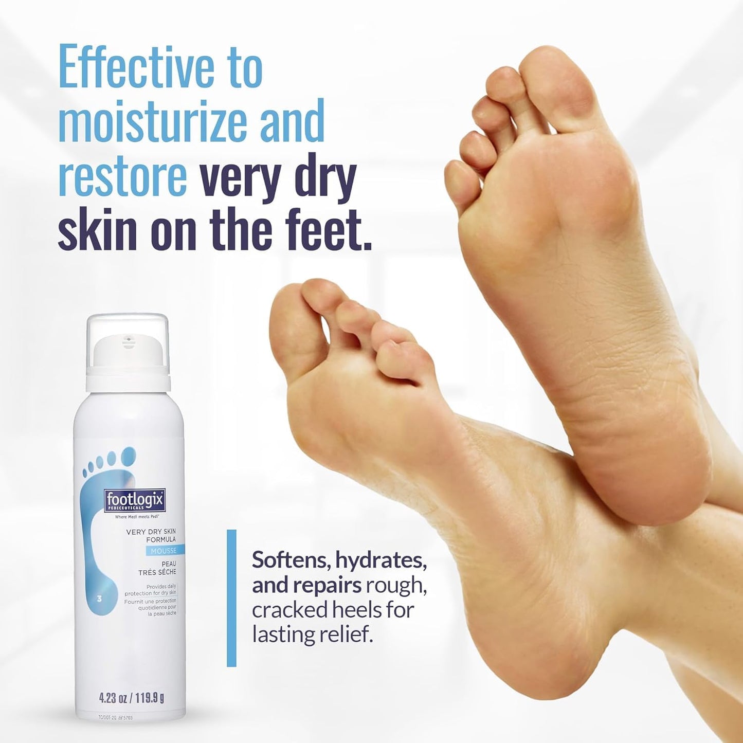 FOOTLOGIX Very Dry Skin Formula Foot Mousse - Urea, Co-Q10, Aloe Vera & Vitamin E | Moisturizing Foot Mousse for Dry & Rough Feet | Fragrance-Free Beauty & Personal Care FOOTLOGIX