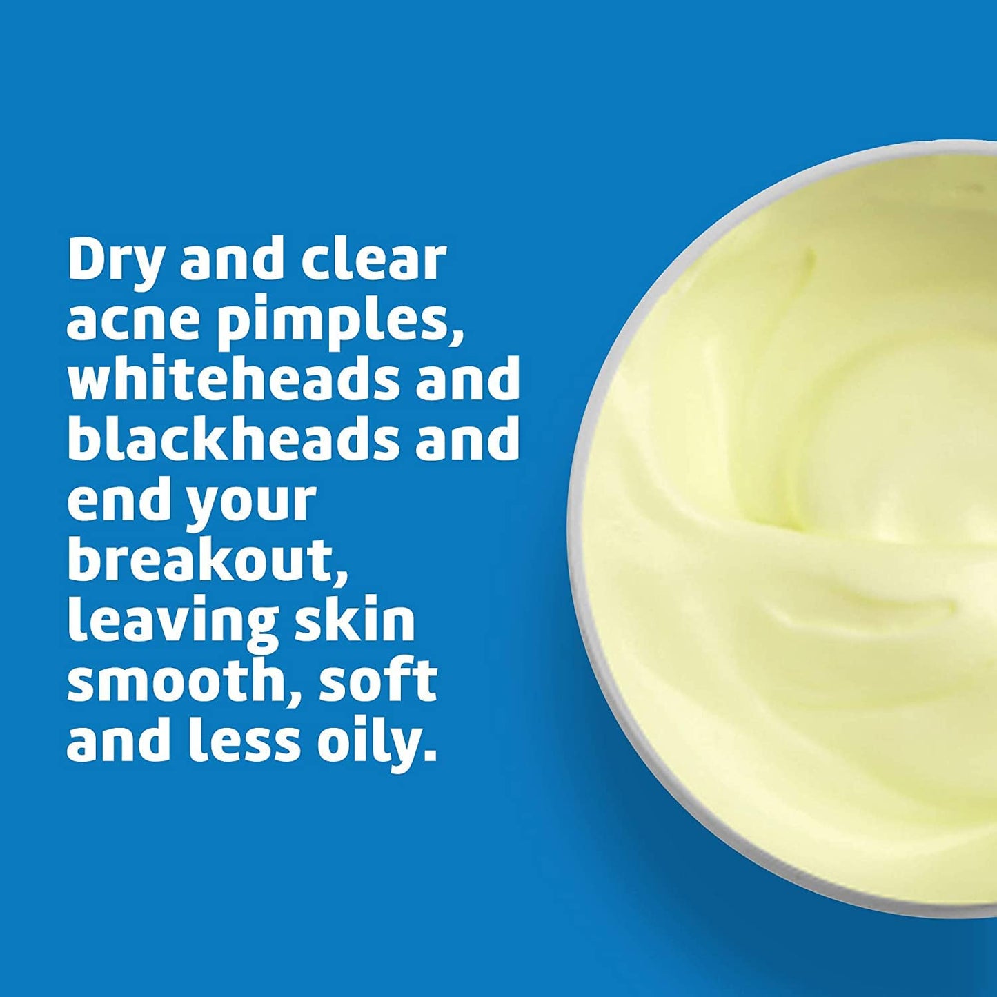 De La Cruz 10% Sulfur Ointment Cystic Acne Spot Treatment for Face & Body Skin Care Face Mask & Blackhead Remover, Treatment for Hormonal Acne 2.6 oz