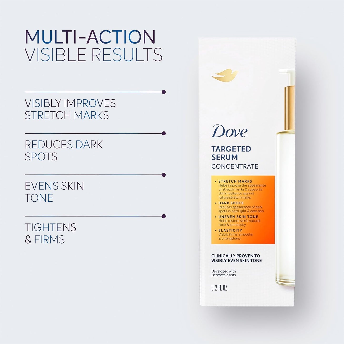Dove Targeted Serum Multipurpose for Stretch Marks, Dark Spots, Uneven Skin Tone and Elasticity,with Tone Balance Complex, Niacinamide, Collagen