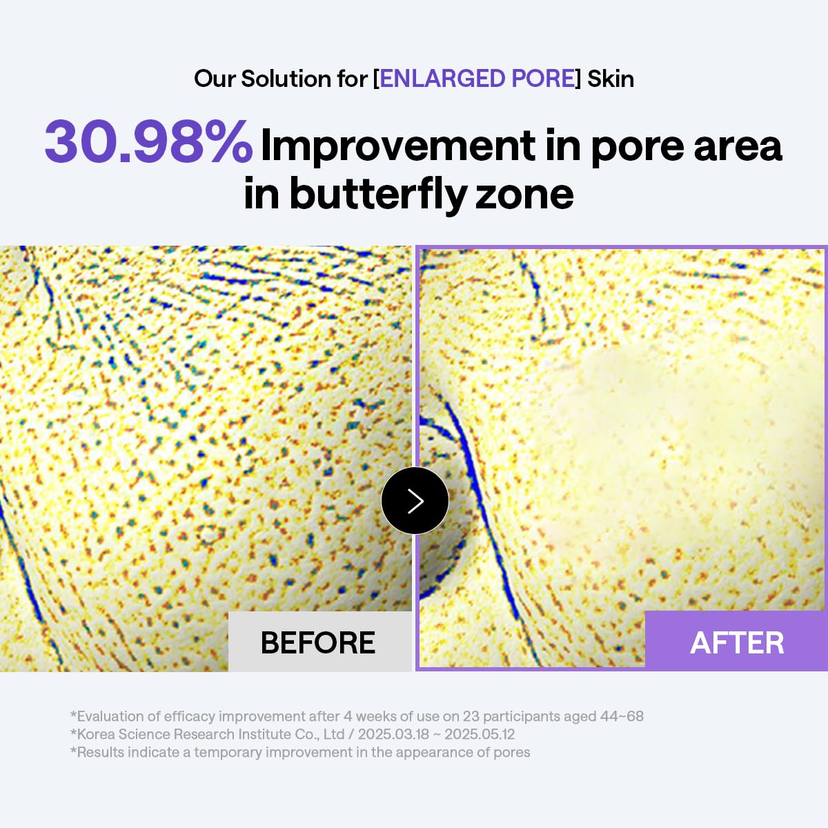 MEDIHEAL Toner Pads 100 Count - PDRN Stretchable Lifting Pads with Squalane and Glutathione for Total Skin Care - Plant Based Rose PDRN - Wrinkle Beauty and Personal Care MEDIHEAL