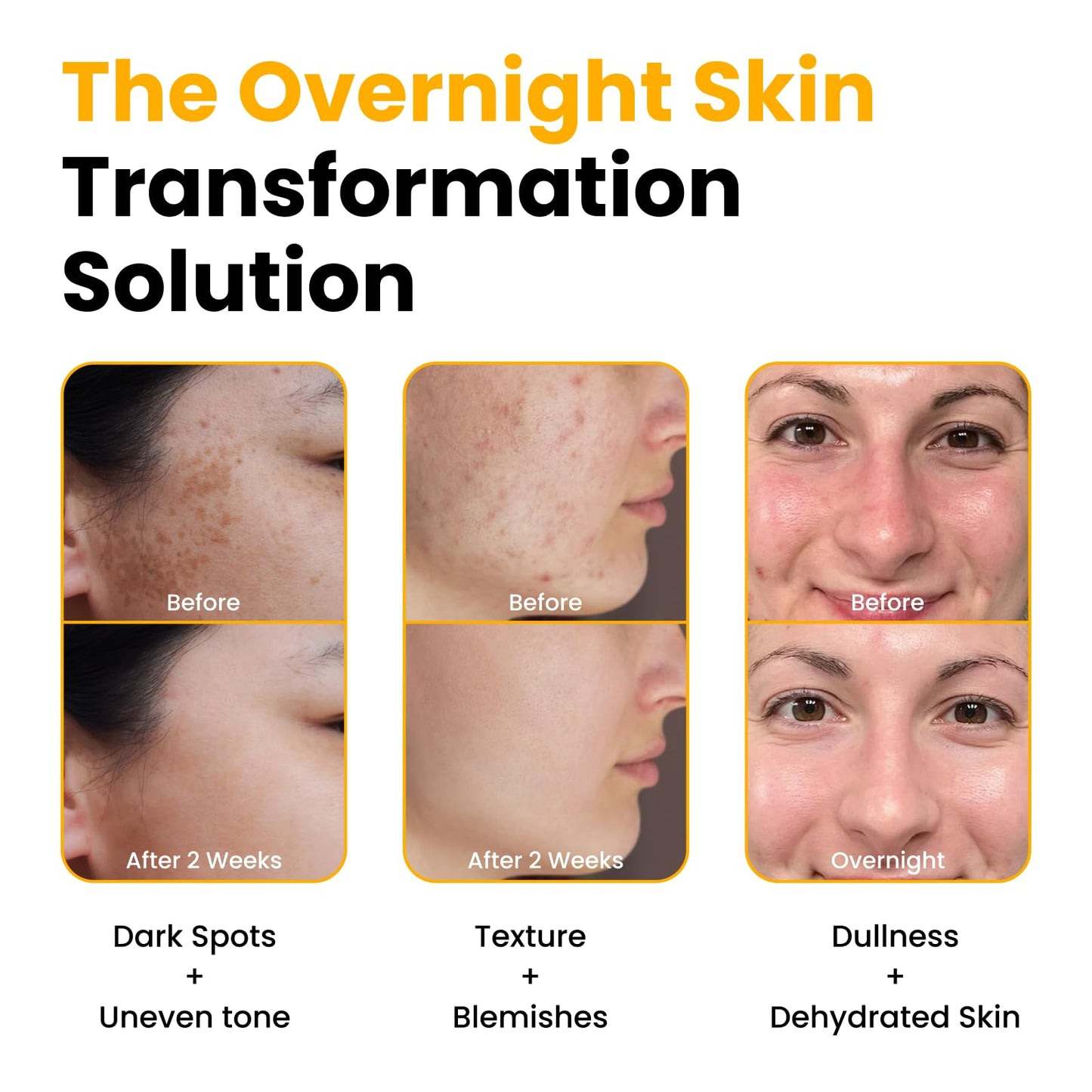 QUIA Turmeric + Kojic Acid Overnight Wrapping Mask - Hydration Mask for Glowing Skin - Evens Tone, Soothes Redness and Improves Skin Texture - Korean Beauty and Personal Care QUIA Beauty