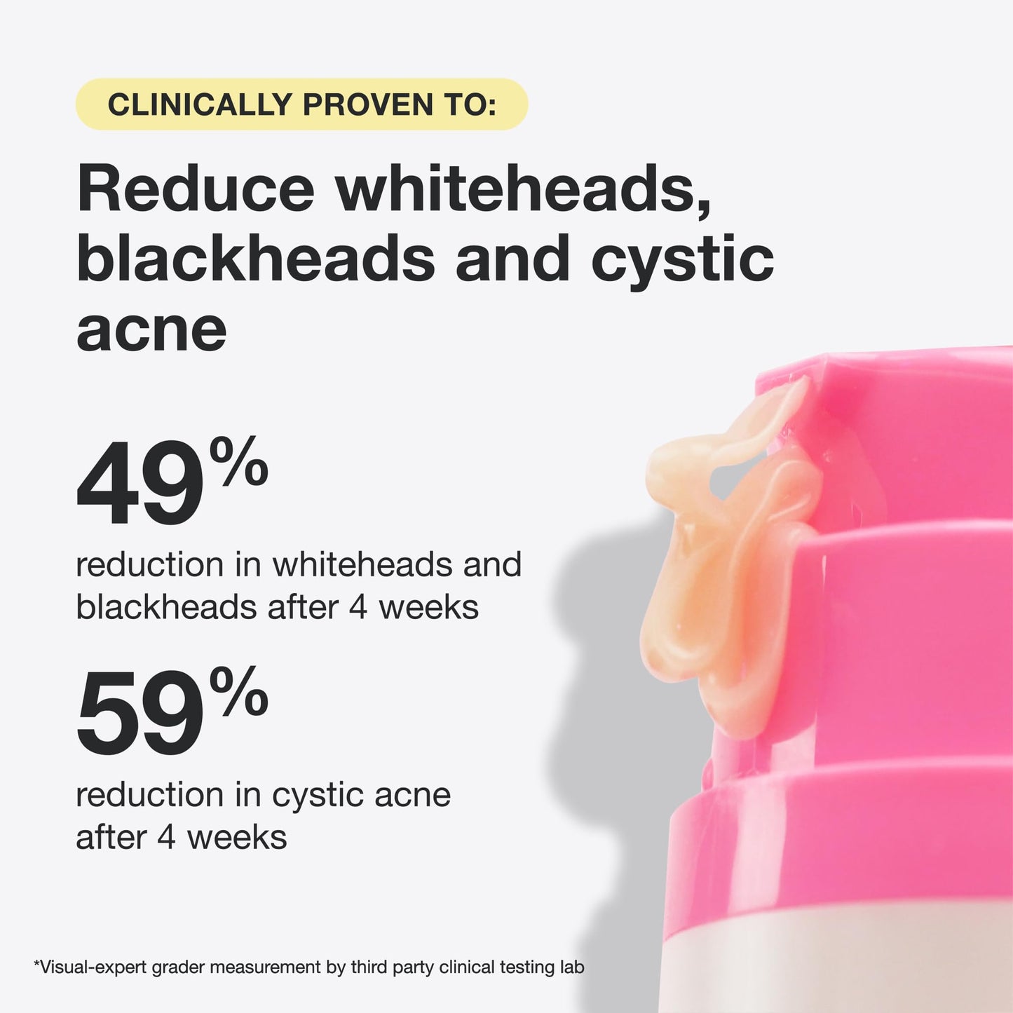 INNBEAUTY Project Acne Serum Medicated Treatment for Breakouts, Blackheads & Oil Control, 1 OZ (30ml)