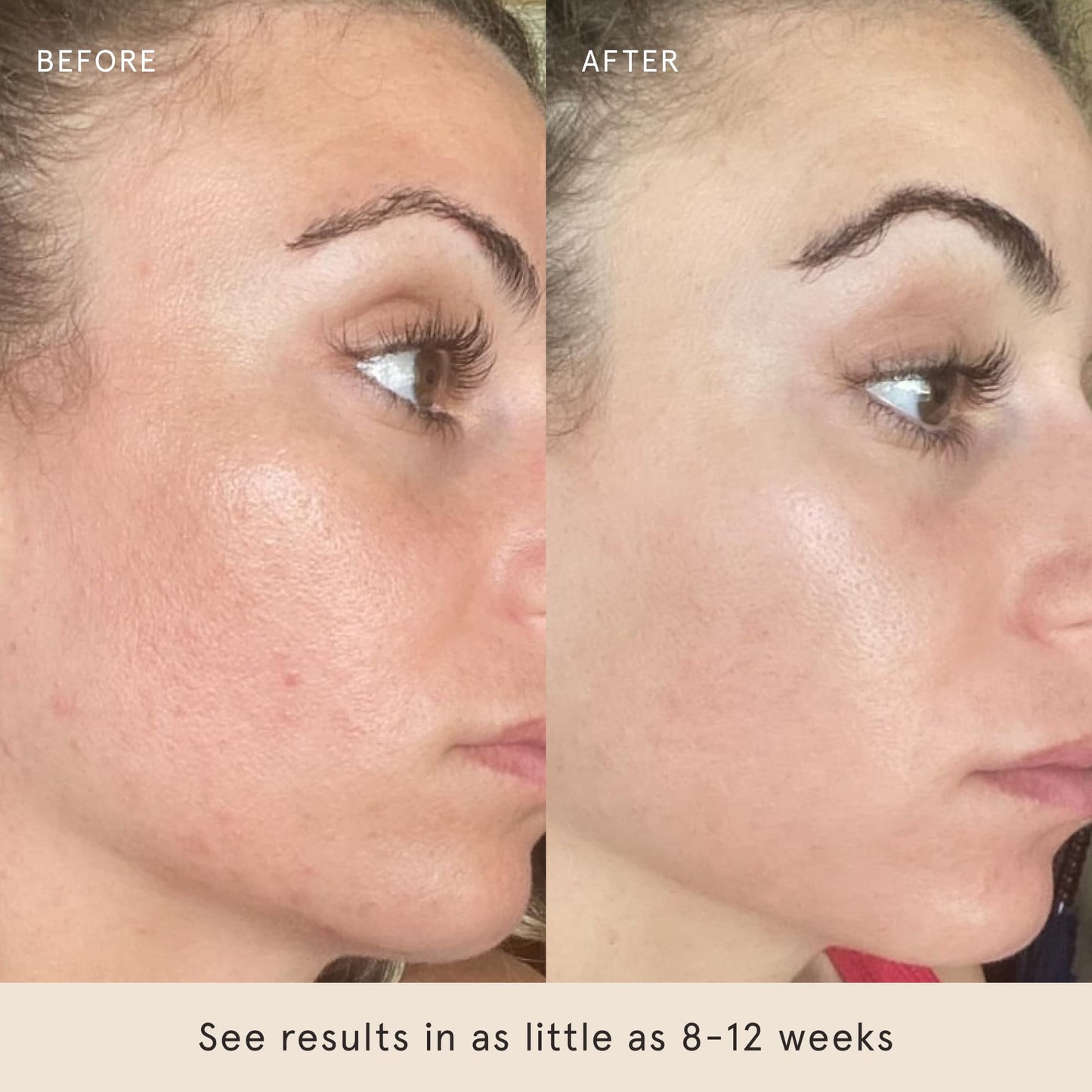 Barefaced Liquid Gold 1 Fl Oz - 15% Vitamin C Serum with Hyaluronic Acid & Vitamin E for Anti-Aging, and Hydration, Antioxidant Formula, Reduces Dark