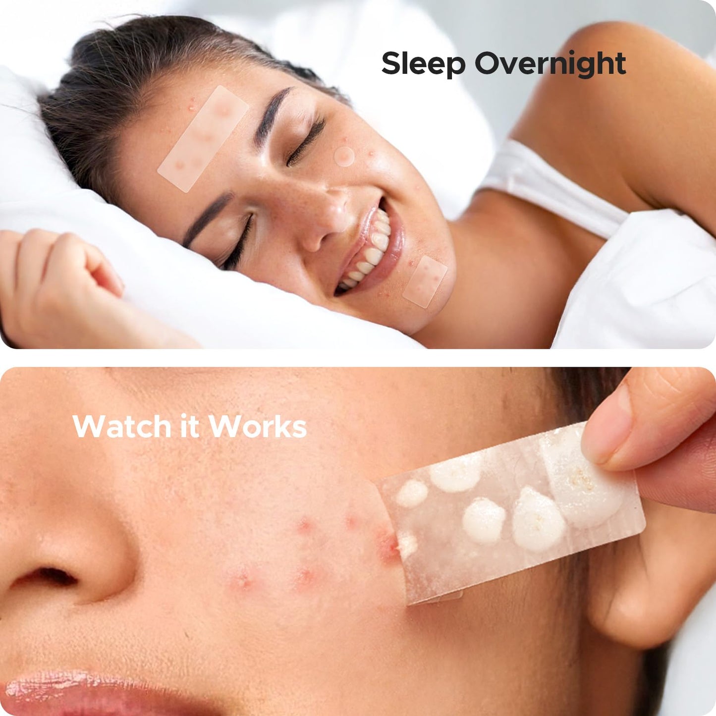 TKTK Large Pimple Patches for Face, 7 Sizes XL Acne Patches, Big Hydrocolloid Bandages for Body, Chin, Forehead, Chest, Back Zit Breakouts Beauty and Personal Care TKTK