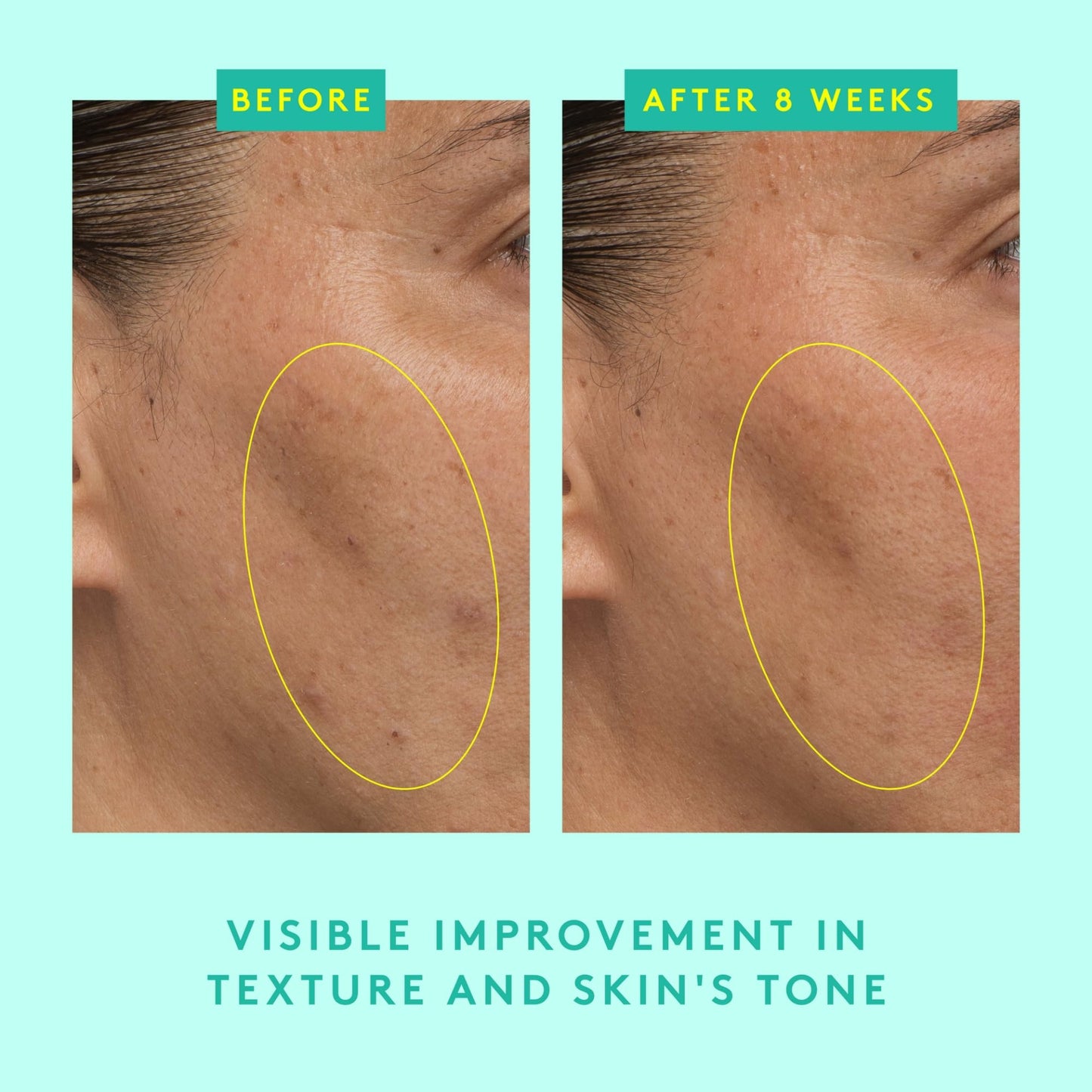 Drunk Elephant Protini Powerpeptide Resurf Serum - 30 ml/1 fl oz - Exfoliating Lactic Acid AHA Serum - Clean Clinical Skincare - Cruelty-Free - Free