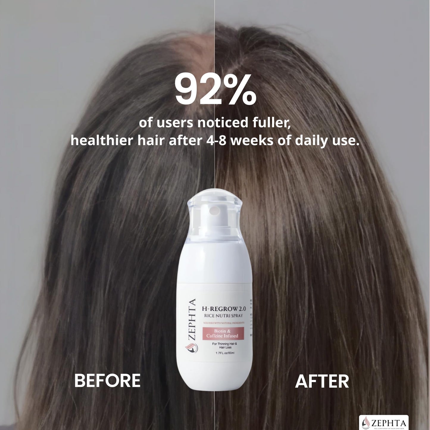 Zephta H-Regrow Hair Growth Spray - With Rice Water, Biotin, Aloe Vera, Caffeine, and Ginger - Hair Growth Product for Men and Women - For Thinning Beauty and Personal Care Zephta