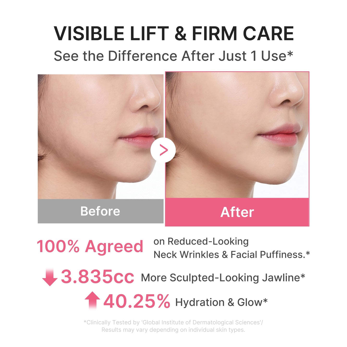 medicube PDRN Collagen Gua Sha Neck Wrinkle Cream | Built-In Gua Sha Massager with Volufiline 5% | Firming, Contour Care for the Look of Fine Lines Beauty and Personal Care medicube