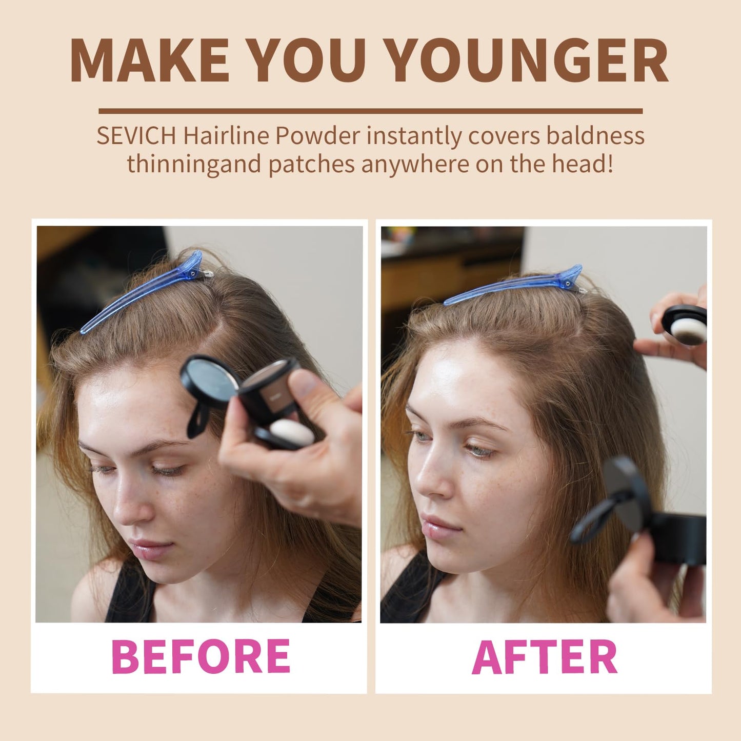 Sevich Hairline Powder,Instantly Conceals Hair Loss, Root Touch up Powder, Hair Shadow Toppers for Women & Men, Touch Up for Thinning Gray Hair Beauty and Personal Care SEVICH