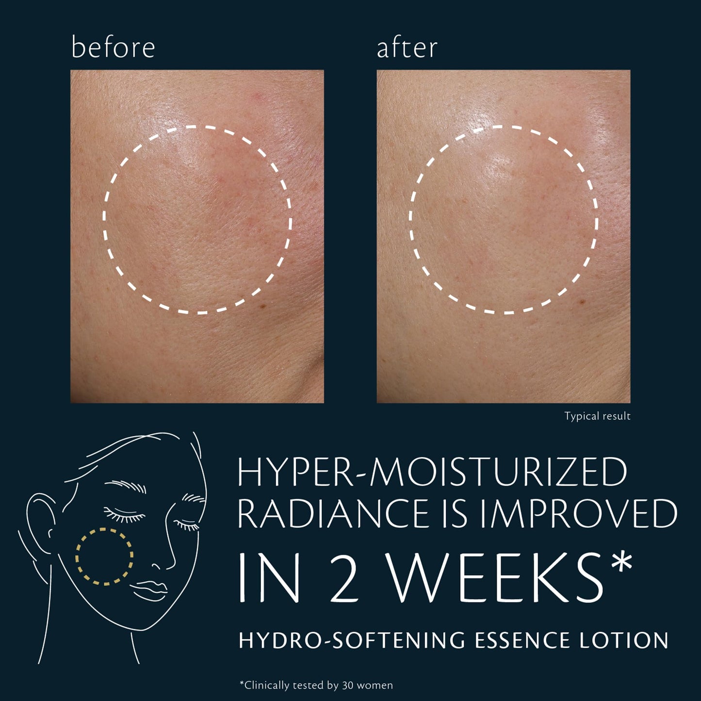 Hydro-Softening Essence Lotion (Refill)