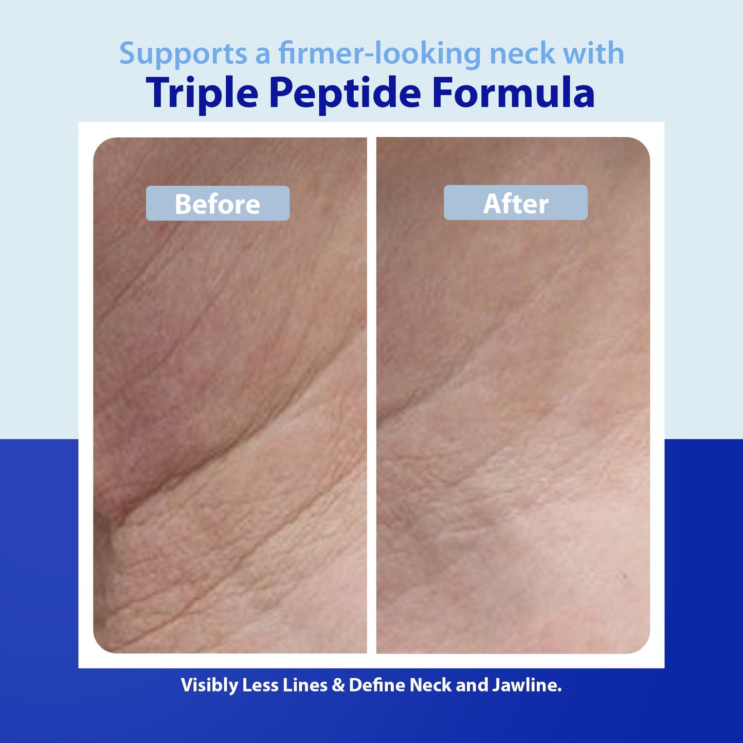 Dr. Denese Triple Strength Neck Wrinkle Smoother 4 oz - Firming Cream with Triple Amount of Peptides Compared to Industry Standards - Retinol