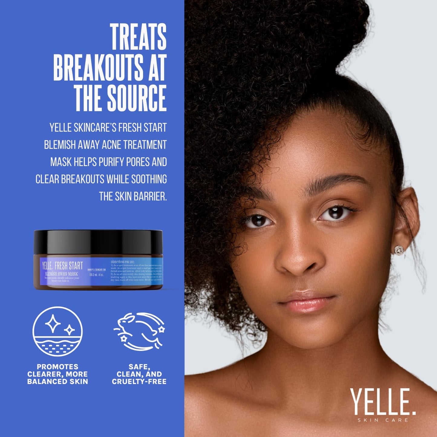 Yelle Skincare - Fresh Start Blemish Away Acne Treatment Mask - Mattifying Face Mask with Witch Hazel, Tea Tree & Organic Herbal Infusions - Gentle
