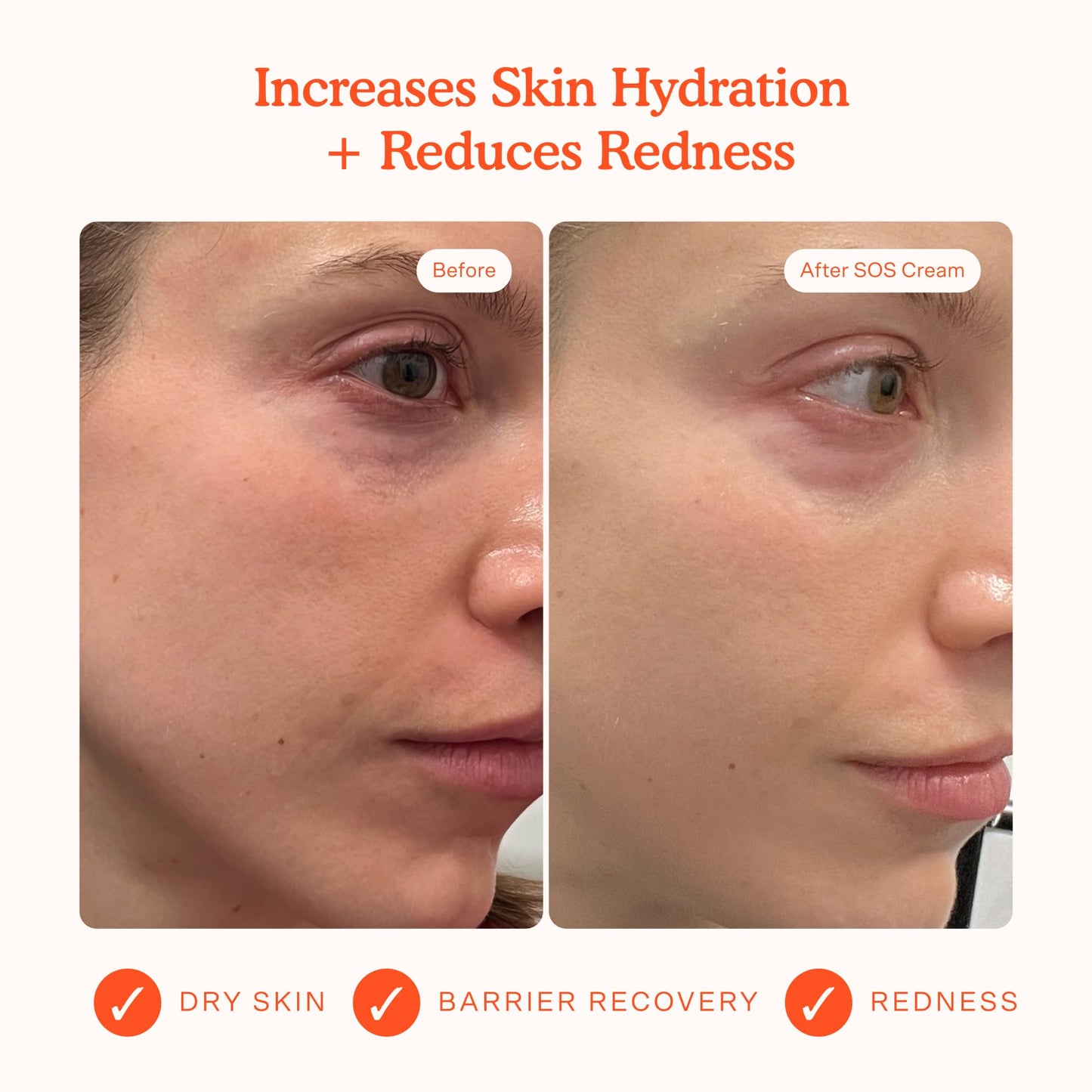 Tower 28 SOS Recovery Face Cream - Hydrating Face Moisturizer with Hyaluronic Acid + Ceramides - Skin Barrier Repair Moisturizer Reduces Redness + Beauty and Personal Care Tower 28