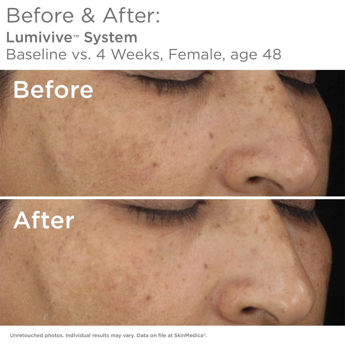 SkinMedica Lumivive Day & Night System - Your Essential Serum Based, Age-Defying Skin Care Set for a Radiant Beauty Routine