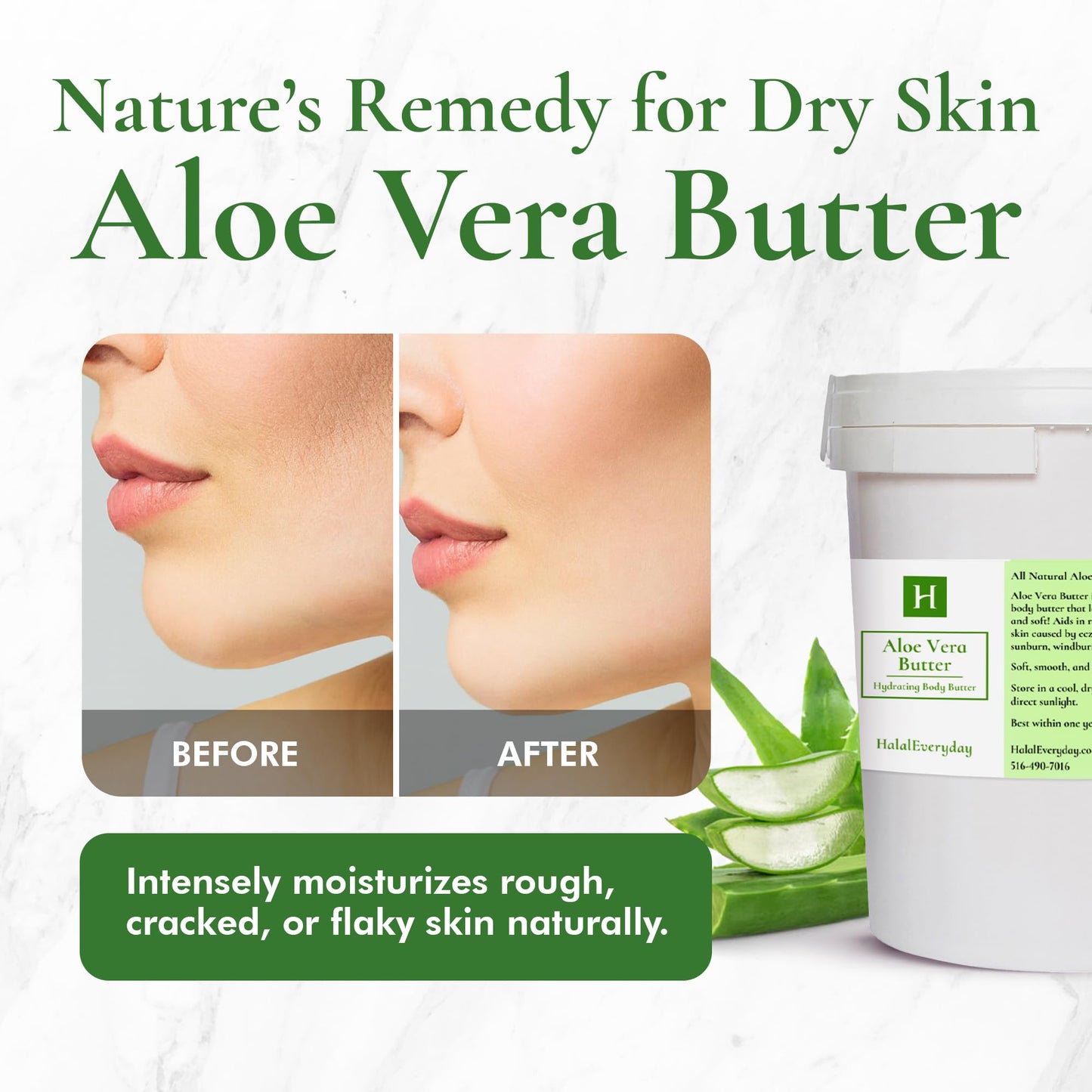 SAAQIN Aloe Vera Butter -Hydration of Dry Skin Caused By Eczema, Psoriasis, Rosacea, Sun Burn, Wind Burn, and General Chapping 16 Oz