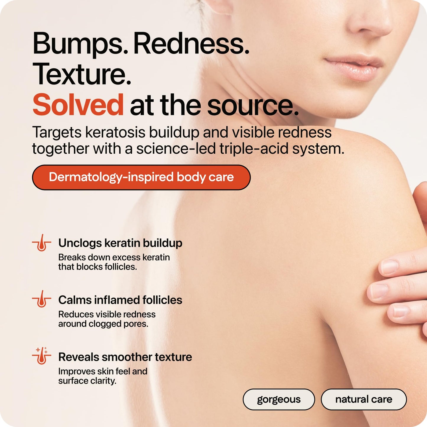 Strawberry® Resurfacing Cream for Keratosis Pilaris - KP Bump Eraser for Strawberry Skin - Exfoliating Lotion with Glycolic, Lactic & Salicylic Acid