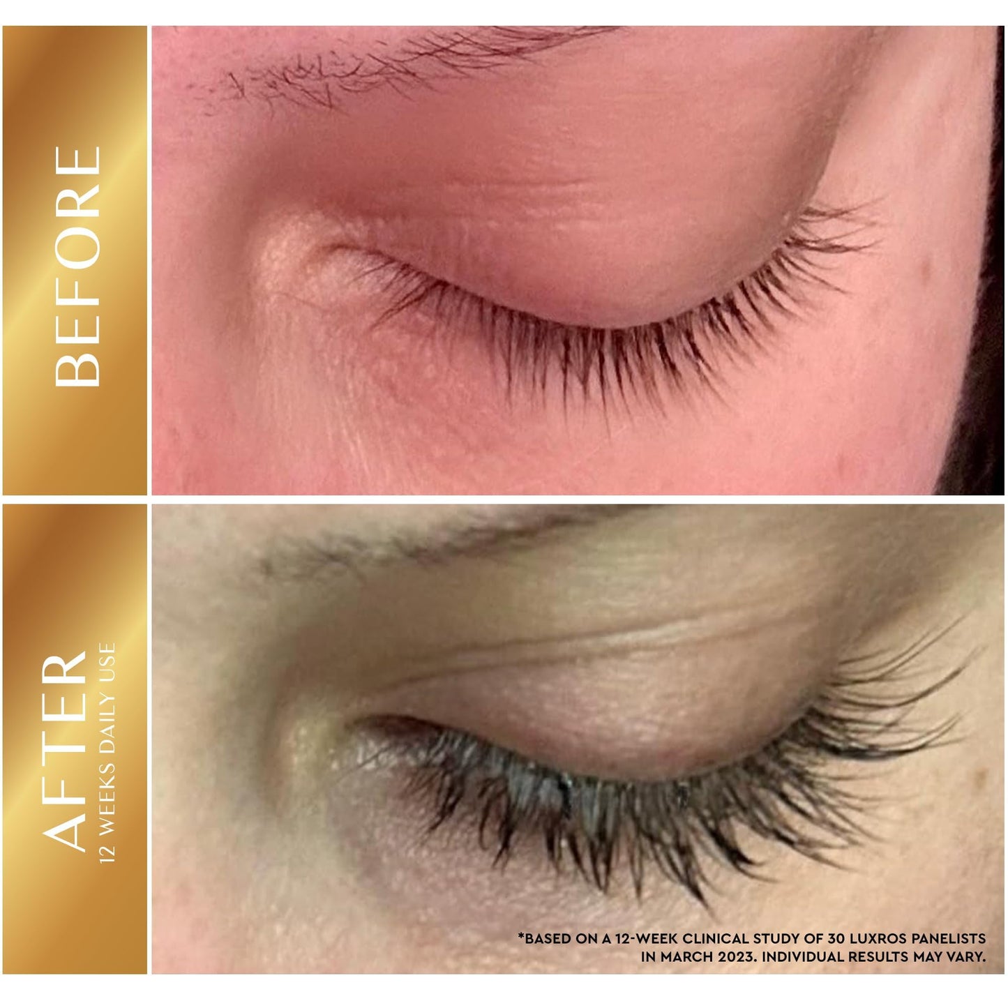 Eyelash Growth Serum 5 mL: Get Thick, Strong Lashes in Just 3-4 Weeks with Our Plant-Based Eyelash Growth Serum - No Parabens - Made in USA