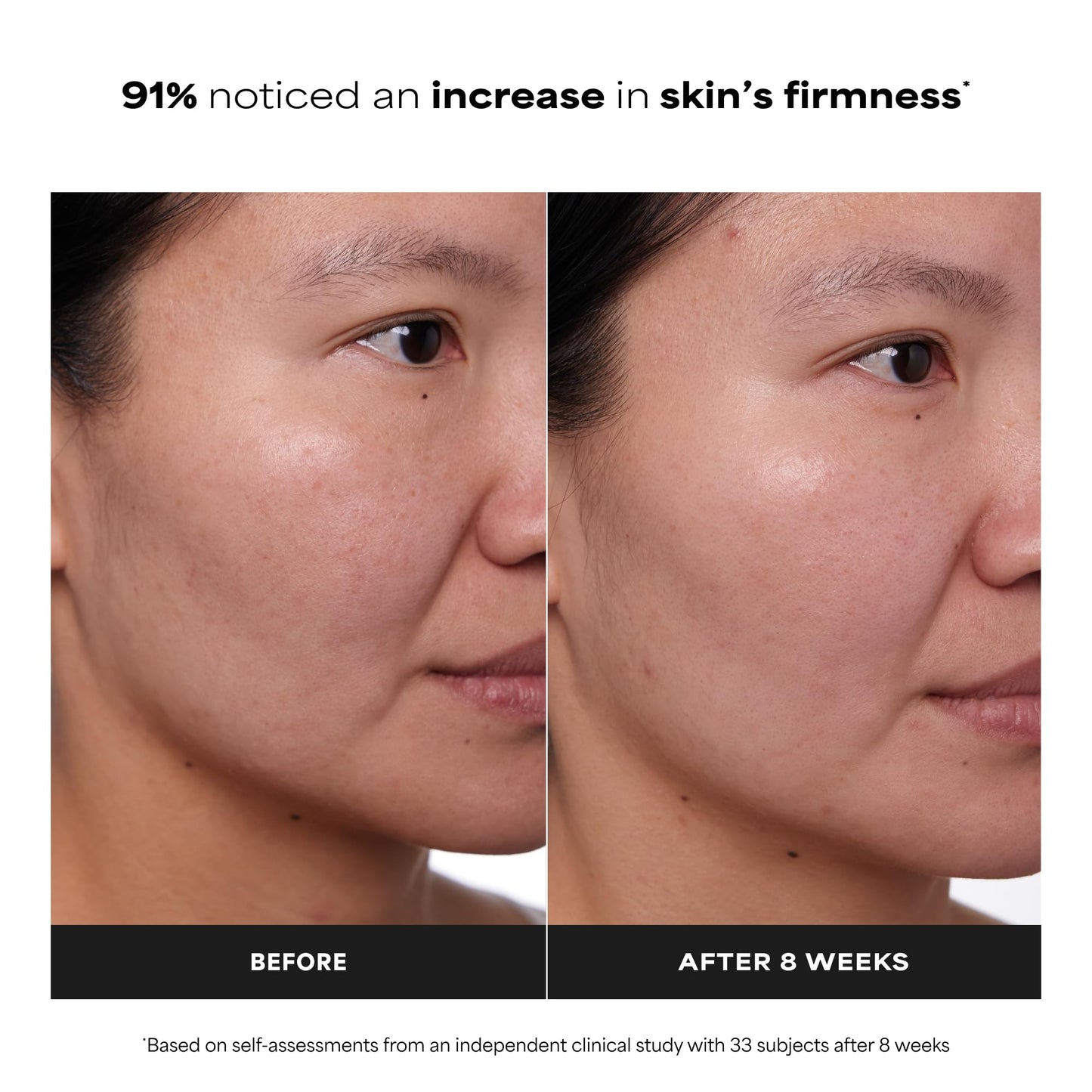 Paula's Choice CLINICAL 1% Retinol Face Treatment with Peptides, Vitamin C & Licorice Extract, Anti-Aging Skin Care Serum, Fine Lines & Wrinkles