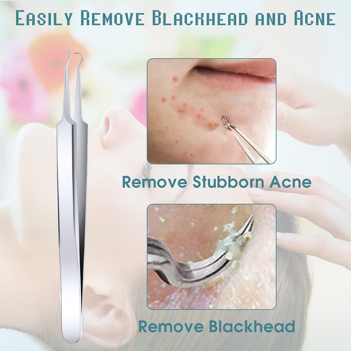 ANCIRS 6 Pack Acne Pimple Blackhead Remover Tweezers, Stainless Steel Acne Tweezers, Curved Pimple Tweezers Extractors Tool for Blackhead Blemish