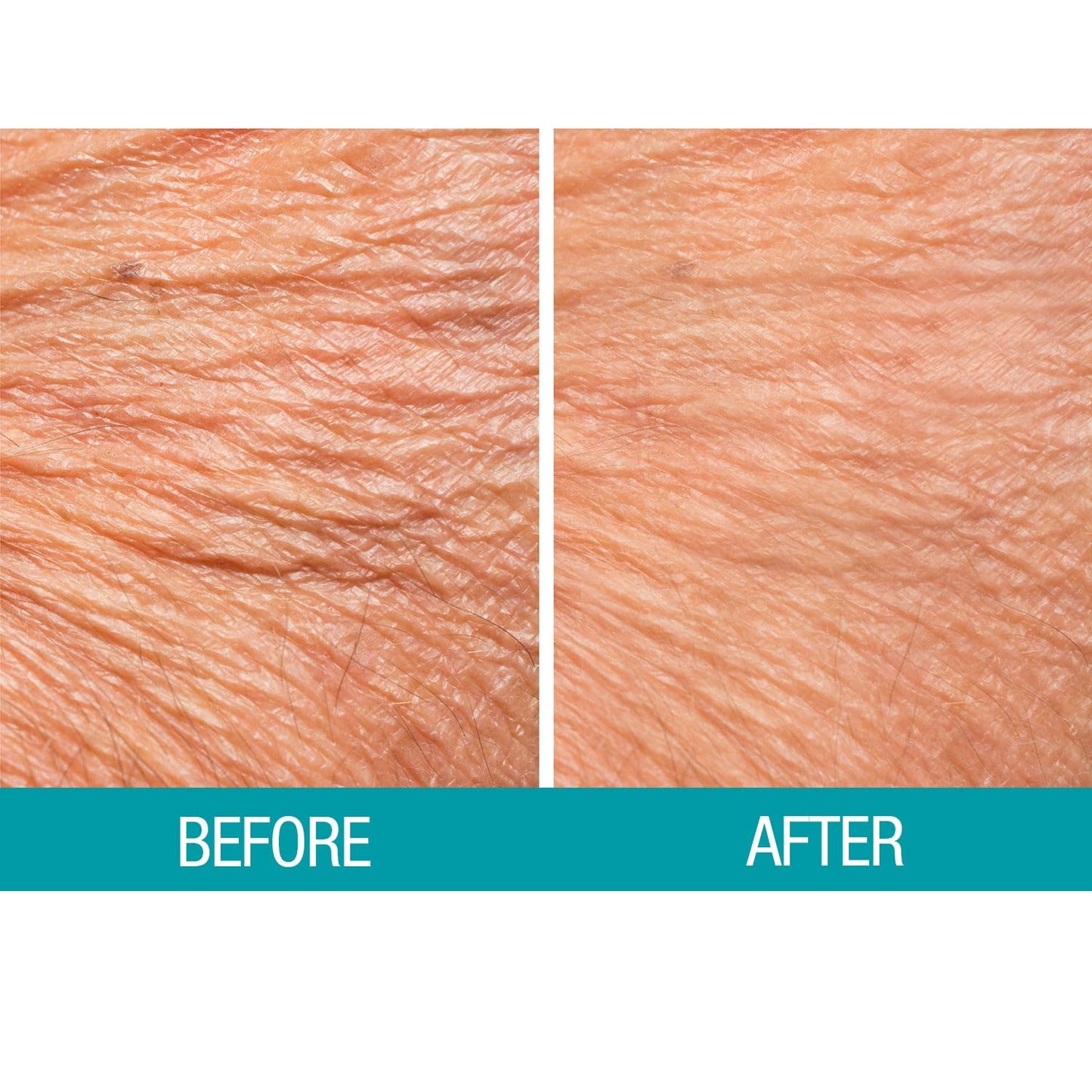 Dermactin Crepe Skin Firming Cream 2.5 oz.