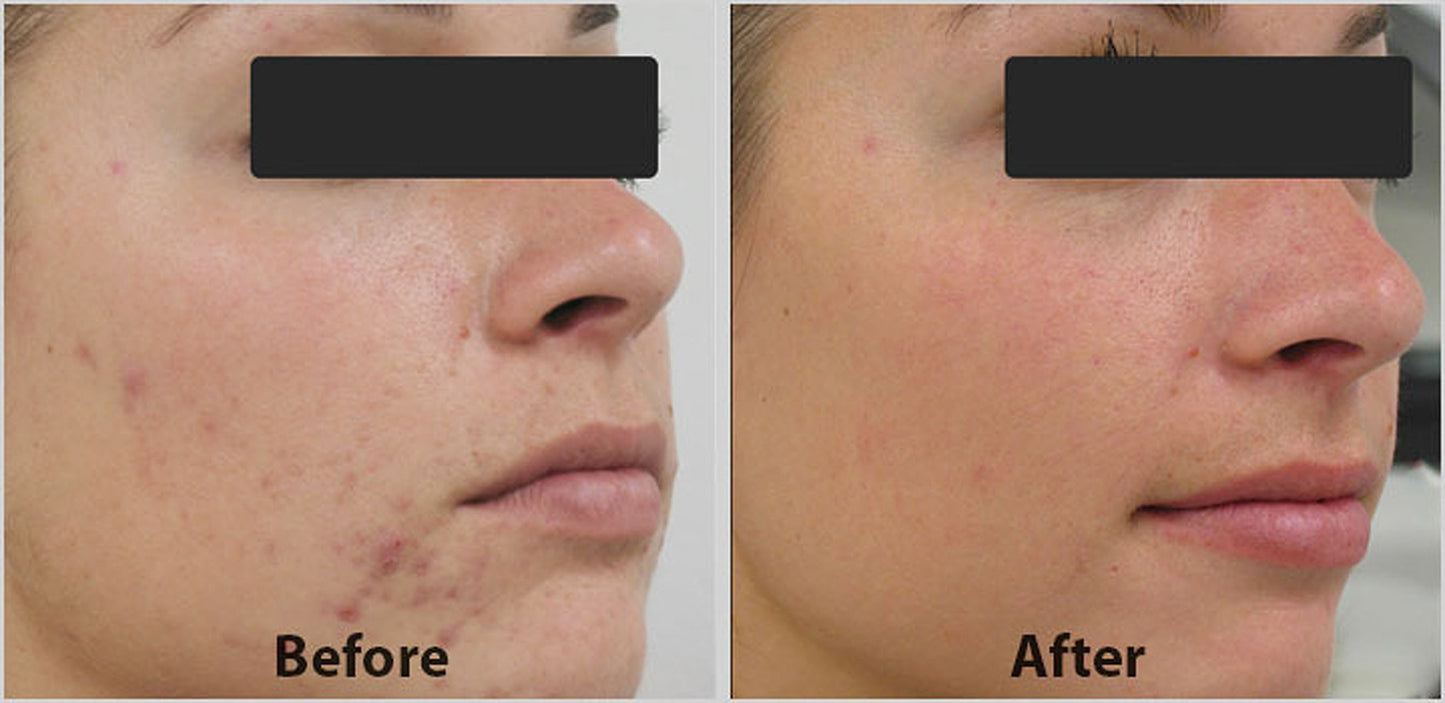 DNA Code®- 20% Glycolic Acid Complex Collagen Rebuild Serum w/Argireline,Matrixyl 3000, CoQ10 Beauty & Personal Care DNA Code