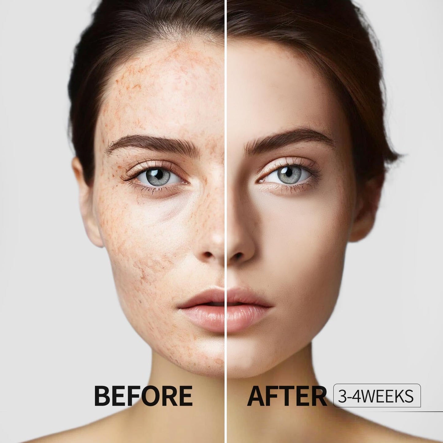HANYWIL Dark Spot Remover for Face and Body, Dark Spot Corrector Serum, Age Spot Sun Spot Freckles Brown Spot Remover, Melasma Treatment for Face