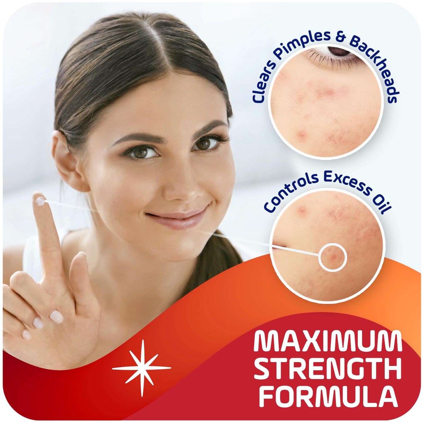 Asepxia 2% Salicylic Acid Acne Spot Treatment Cream | Drying Formula Targets Acne, Clears & Prevents Blemishes, Reduces Redness, Penetrates Pores