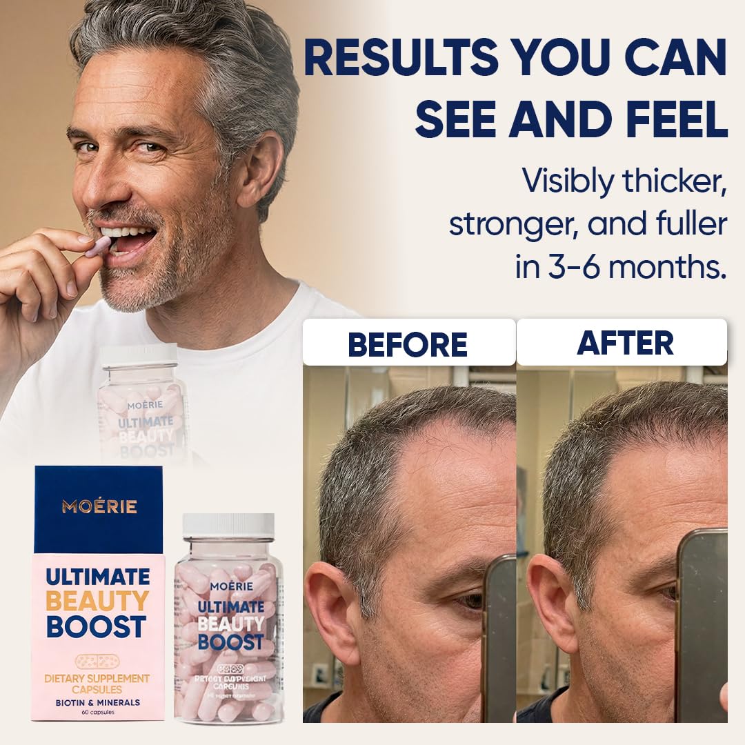 Moerie Ultimate Hair Boost Supplements for Women & Men - Hair, Skin, Nails Vitamins with Biotin & Minerals for Hair Health - Thicker Hair - 60 Beauty and Personal Care Moerie