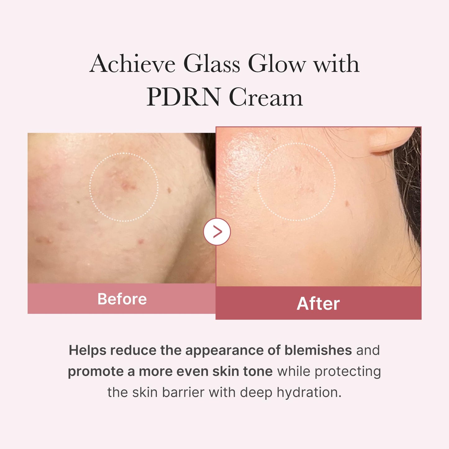medicube Salmon DNA PDRN Pink Hyaluronic Moisturizing Cream Beauty and Personal Care medicube