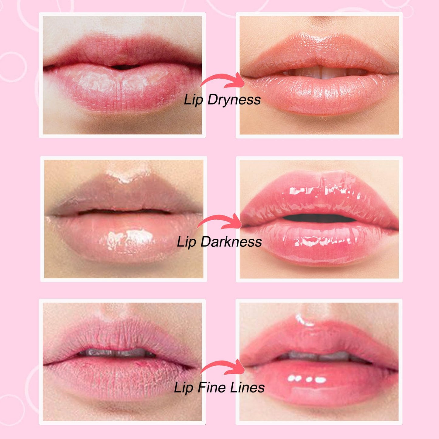NIYET 30 pieces of Moisturizing Collagen Crystal Lip Mask - Anti-Ageing & Anti Chapped, Reduce lip Wrinkles, Fade Lip Color, Make Skin Smooth