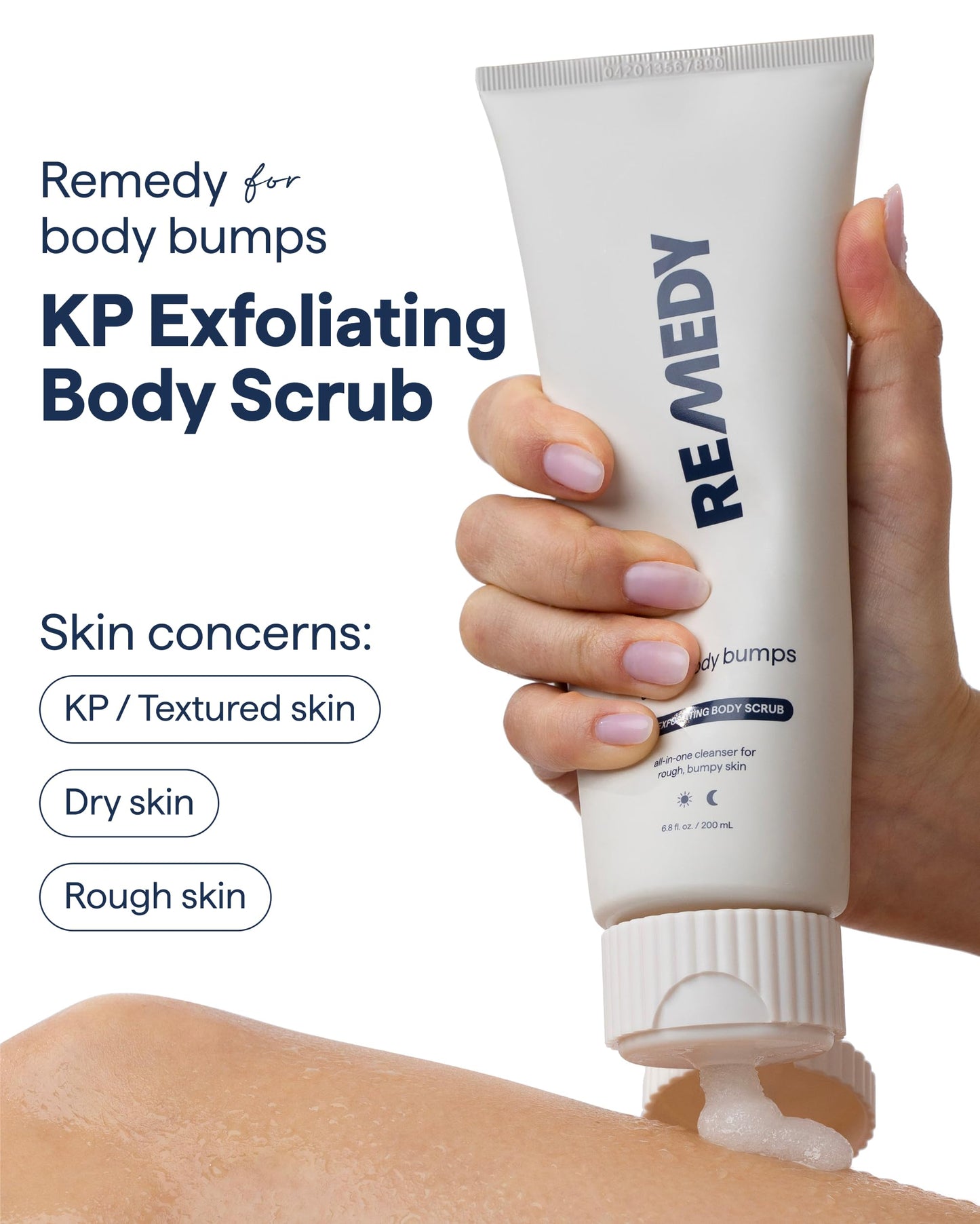 Remedy KP Exfoliating Body Scrub | Keratosis Pilaris and Chicken Skin Treatment with Fine Sugar, Glycolic Acid, Lactic Acid and Squalane | Exfoliating Beauty and Personal Care Remedy Science