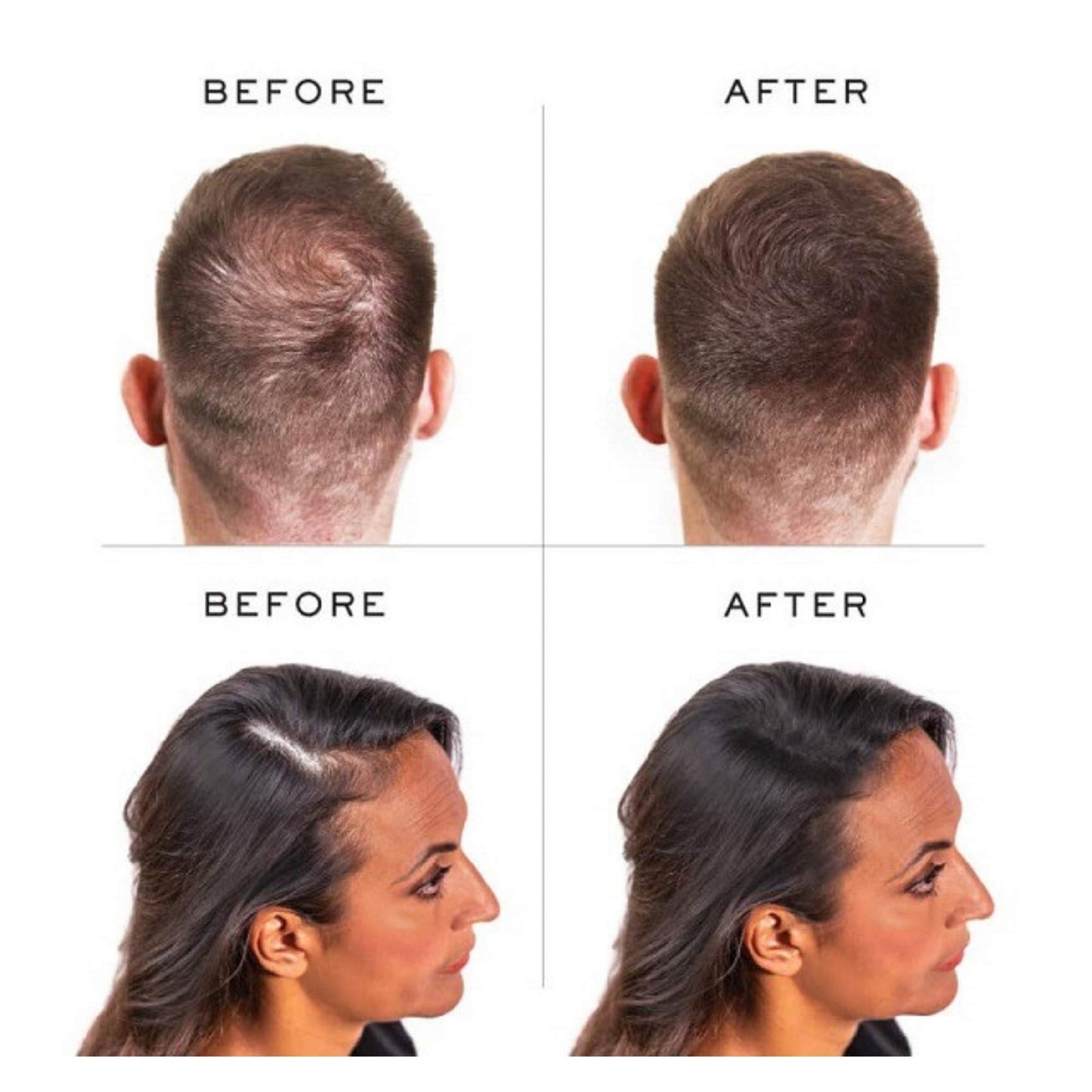 PROCOVR Hair Loss Concealer Cream - The ORIGINAL Thinning & Balding Hairline Enhancer, Hair Mascara for Natural Coverage & Thicker Appearance (Smoke