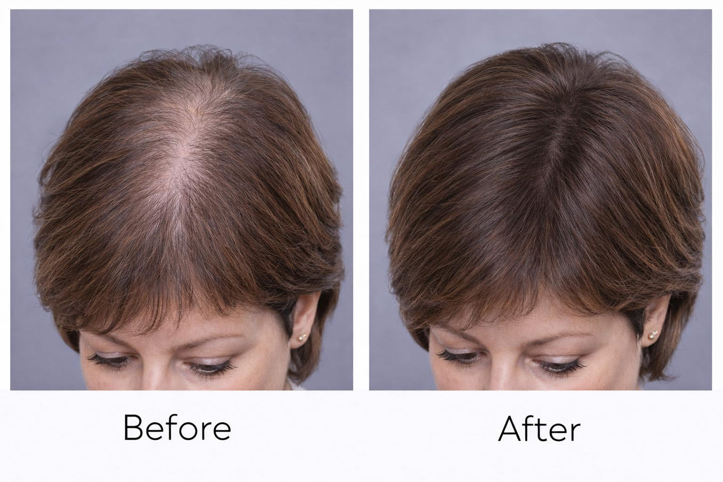 diCesare NEW! 2-n-1 Thicken Natural Hair Builder Dark Brown Custom Formulation Covers Thinning Areas and Attaches to Existing Hair Appearing Thicker