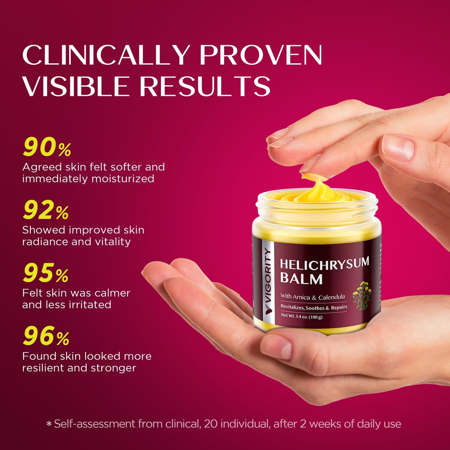 Vigority Helichrysum Balm Soothes & Repairs: Restorative Cream with Arnica & Calendula for Thin, Fragile, Bruised & Aging Skin - Moisturizes Beauty and Personal Care Vigority