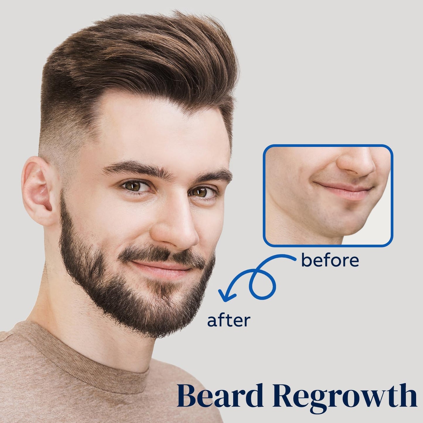 5% Minoxidil for Men Beard and Hair, Minoxidil for Women Hair Growth Spray with Biotin & Castor Oil, Strengthens Weak Roots, Repairs Thinning Hair Beauty and Personal Care FUZYAT
