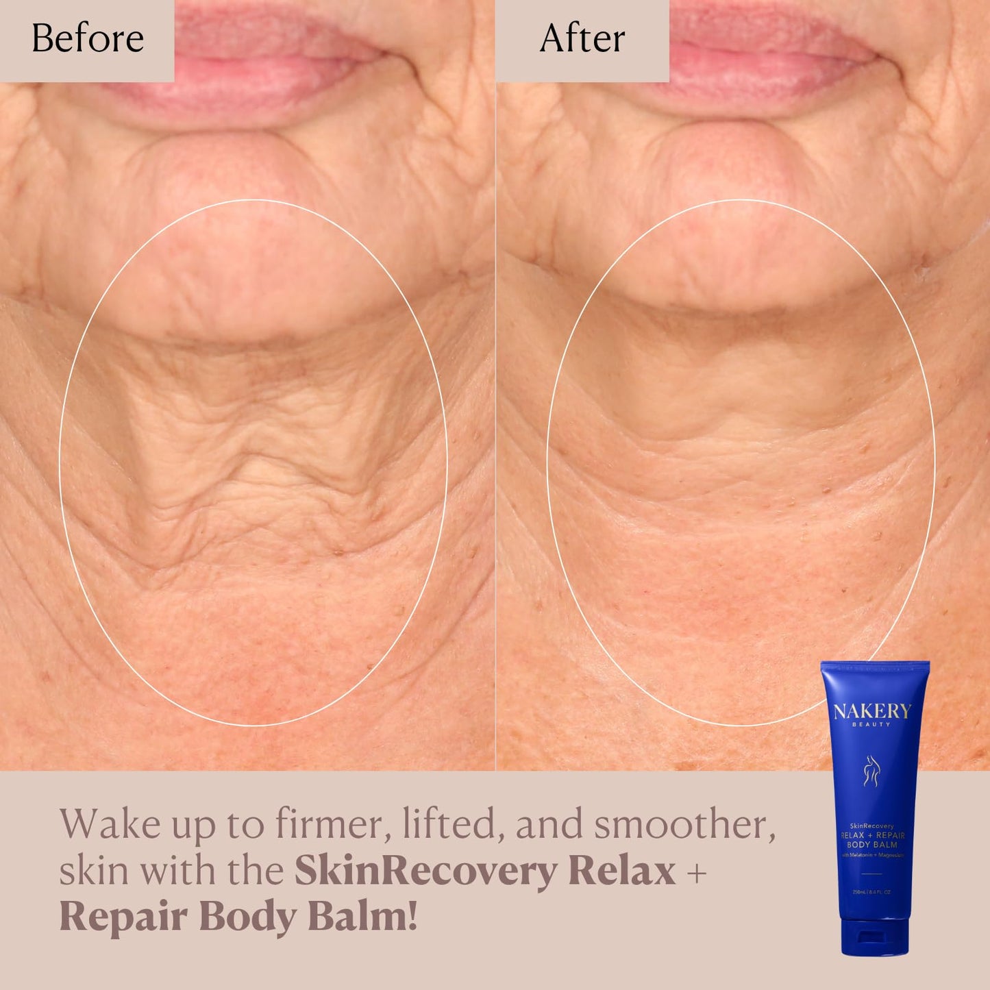 Nakery Beauty SkinRecovery Relax + Repair Body Balm, Magnesium Melatonin Sleep Lotion with Retinol + SepiLift, Firming Cream for Crepey Sagging Skin