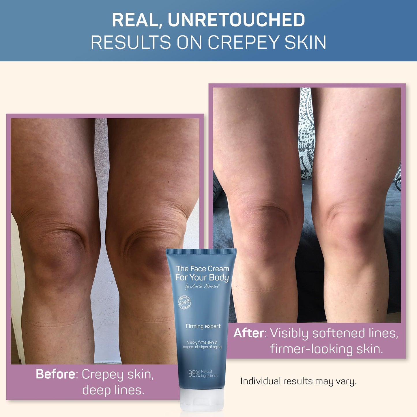 Crepe Firming Advanced Cream - European Hi-tech Skin care - Hyaluronic Acid in the 50-3000 kDa Molecular Spectrum - Tightening & Lifting Collagen