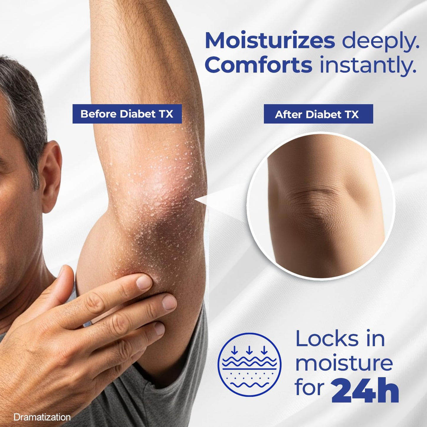 Goicoechea Diabet TX Diabetic Lotion with Urea for Dry Skin | Soothing Hydrating Cream with Aloe, Oatmeal & Vitamin E for Hands, Elbows, Feet & Body |