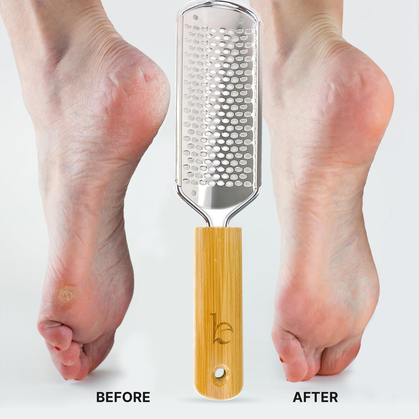 Foot File - Callus Remover Tool for Dead Skin Removal, at Home Pedicure Tools, Foot Rasp Callus Remover Feet and Heels, Smooth Soft Feet Using a