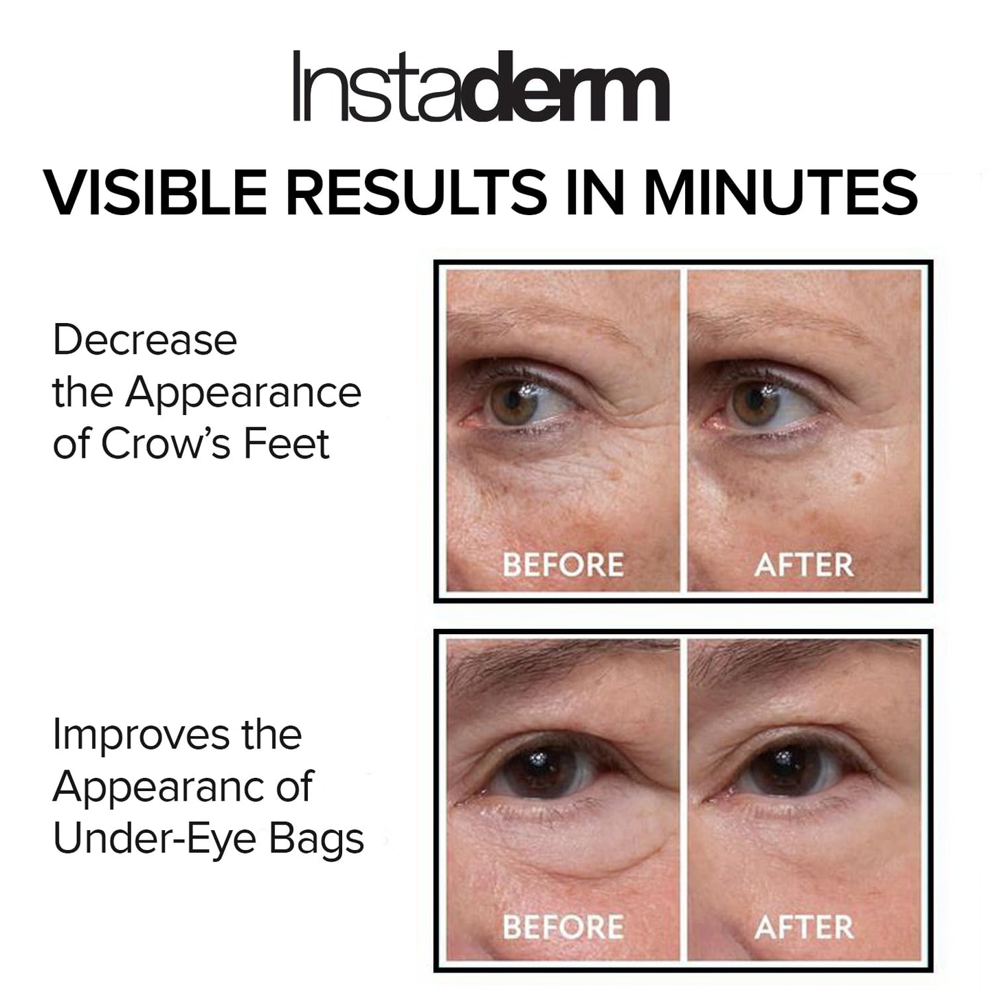 Instant Eye Tightener - Removes Under Eye Bags & Puffiness. Eliminate Dark Circles & Wrinkles. Naturally Ageless Hydrating Cream. Disappears Before