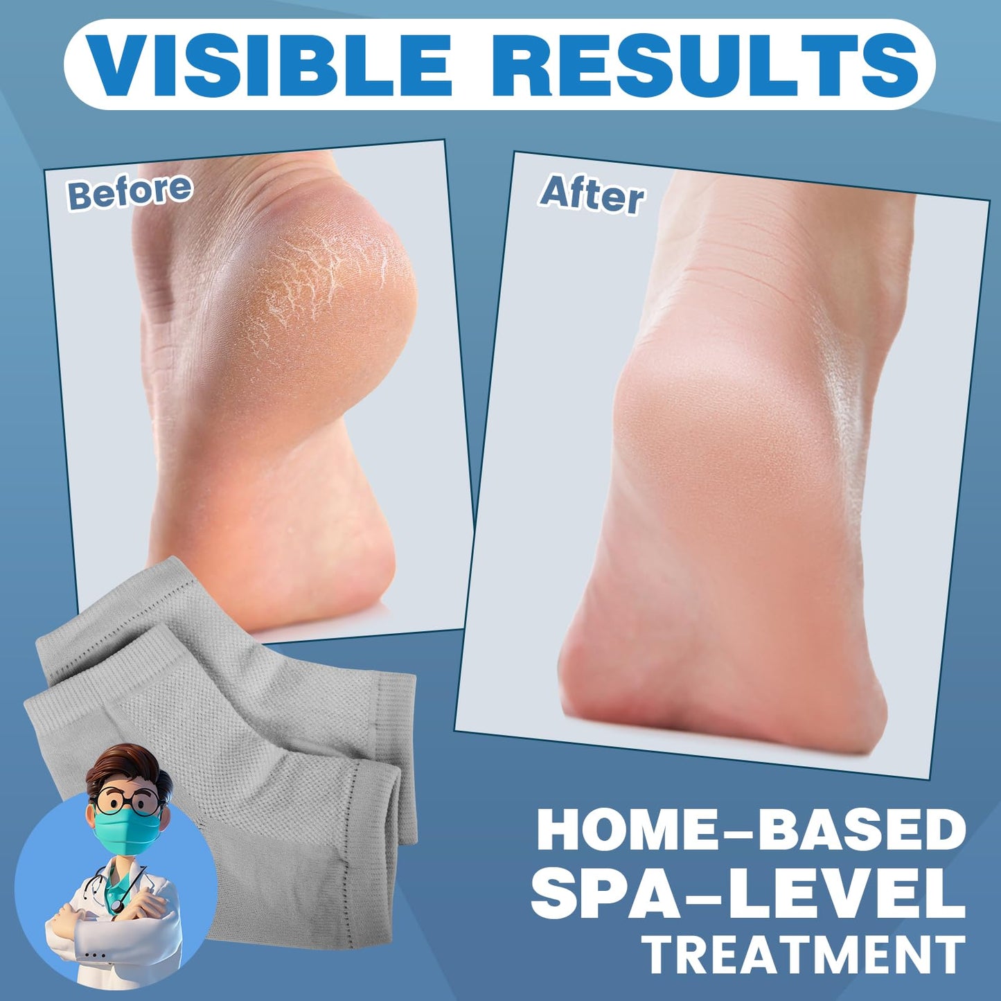 TEAWOO 6 Pairs Moisturizing Heel Socks for Cracked Heel Treatment, Foot Care Toeless Socks to Soften and Hydrate Dry Cracked Feet Heels, Cracked Heel Beauty and Personal Care TEAWOO