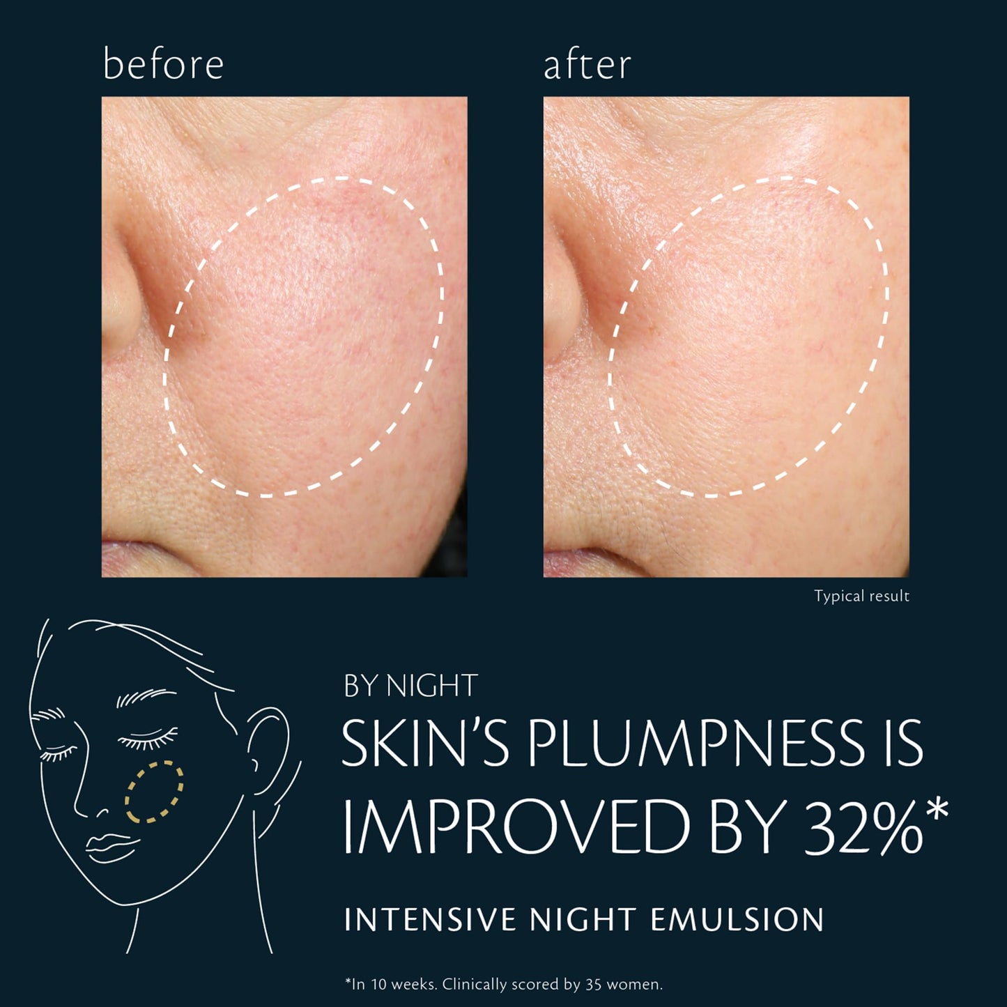 Intensive Night Emulsion