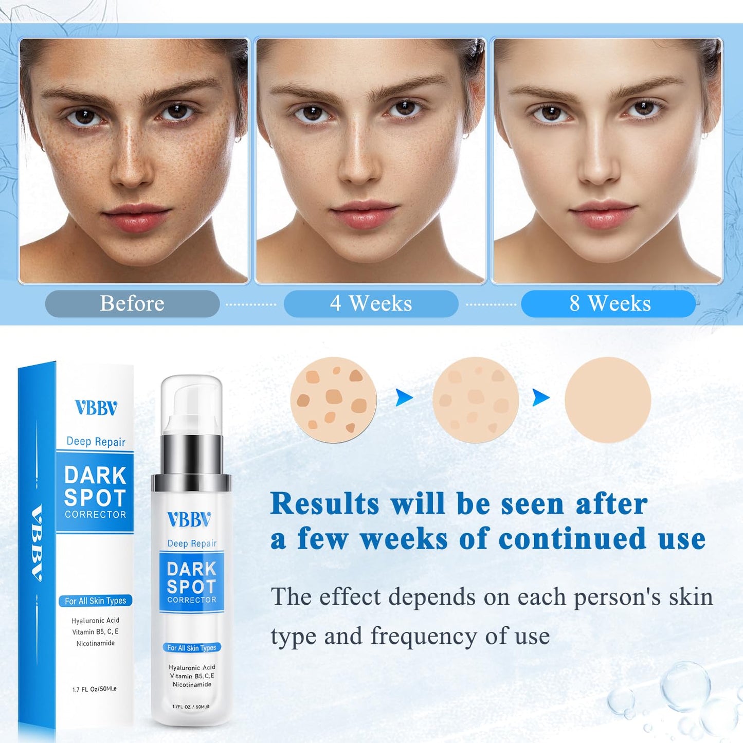 VBBV Dark Spot Remover for Face and Body, Dark Spot Corrector, Sun Spot Freckles Hyperpigmentation Treatment, Advanced Dark Spot Remover Cream