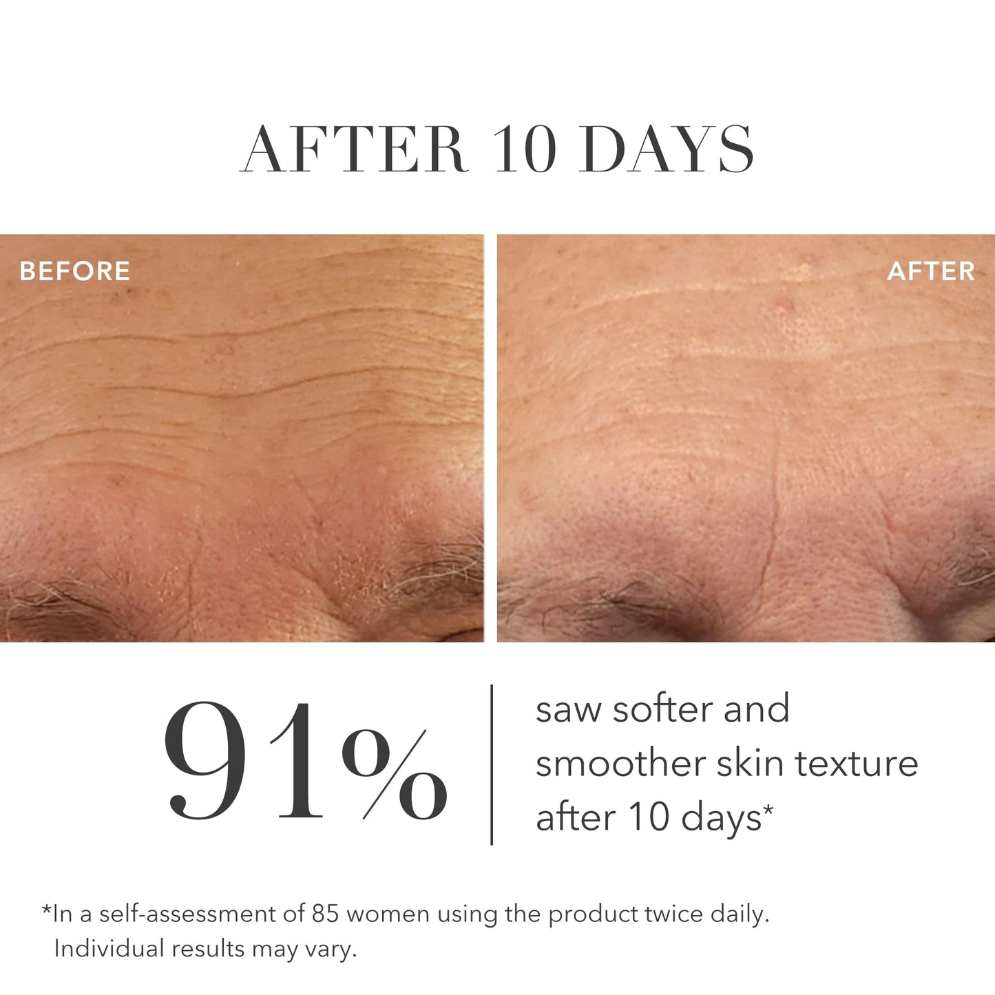 Algenist GENIUS Liquid Collagen Serum - Firming and Hydrating Face Serum with Collagen + Vitamin E - Helps Visibly Minimize Fine Lines + Wrinkles