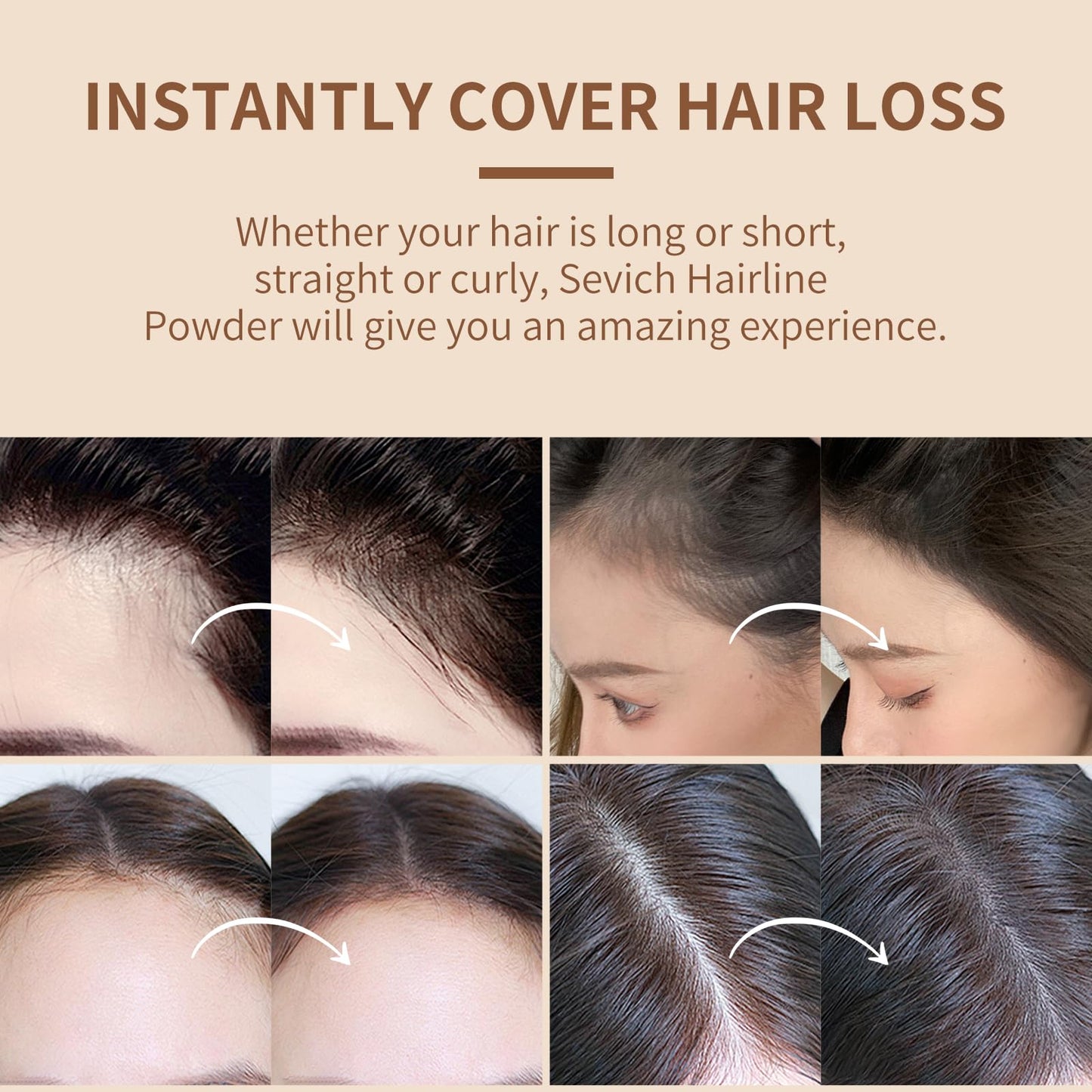 Sevich Hairline Powder,Instantly Conceals Hair Loss, Root Touch up Powder, Hair Shadow Toppers for Women & Men, Touch Up for Thinning Gray Hair Beauty and Personal Care SEVICH