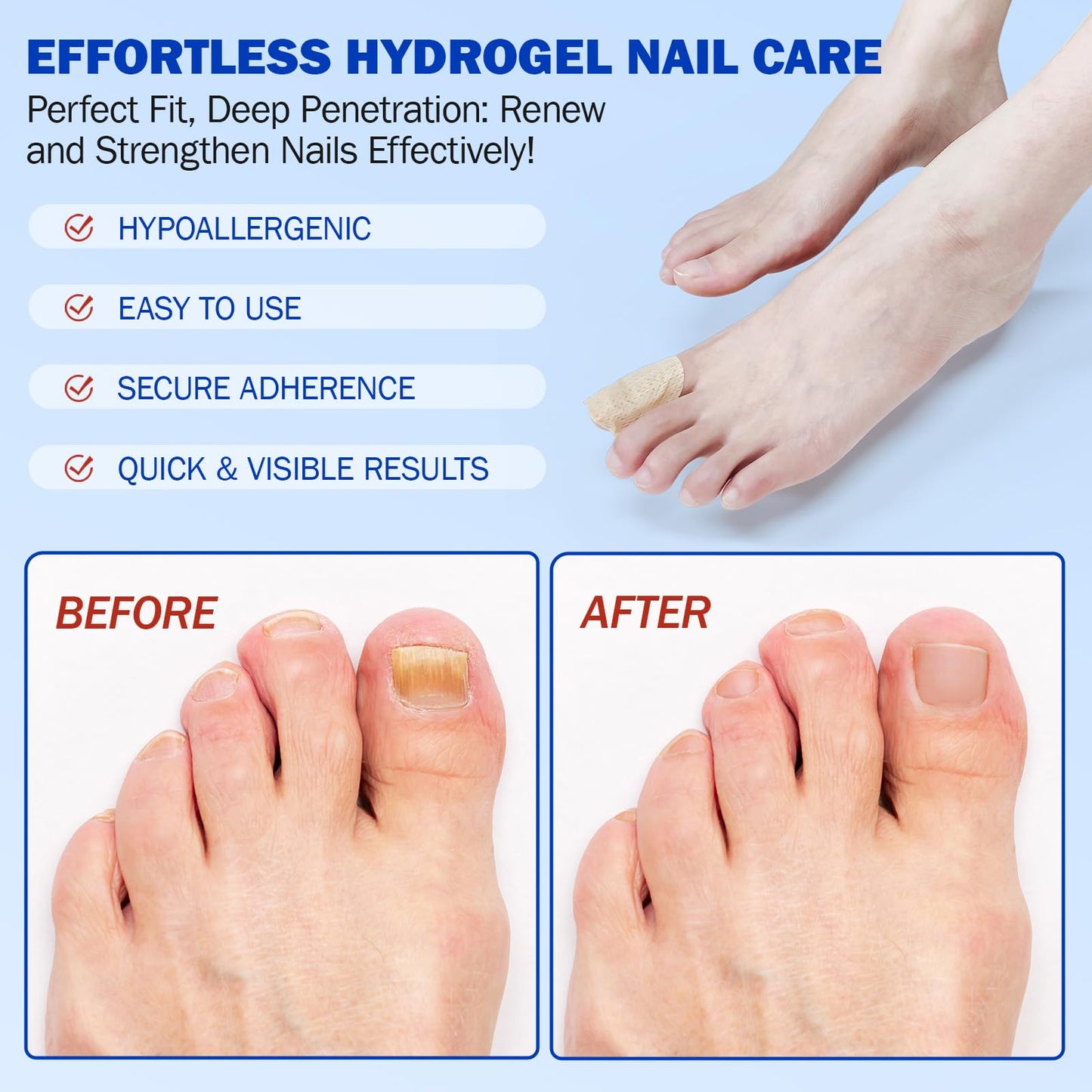 Fungal Nail Patches 42 PCS, Toenail Treatment Extra Strength 8-Hour Overnight Nail Fast Acting Repair Effortless Hydrogel Nail Care and Repair Beauty and Personal Care FANSHI