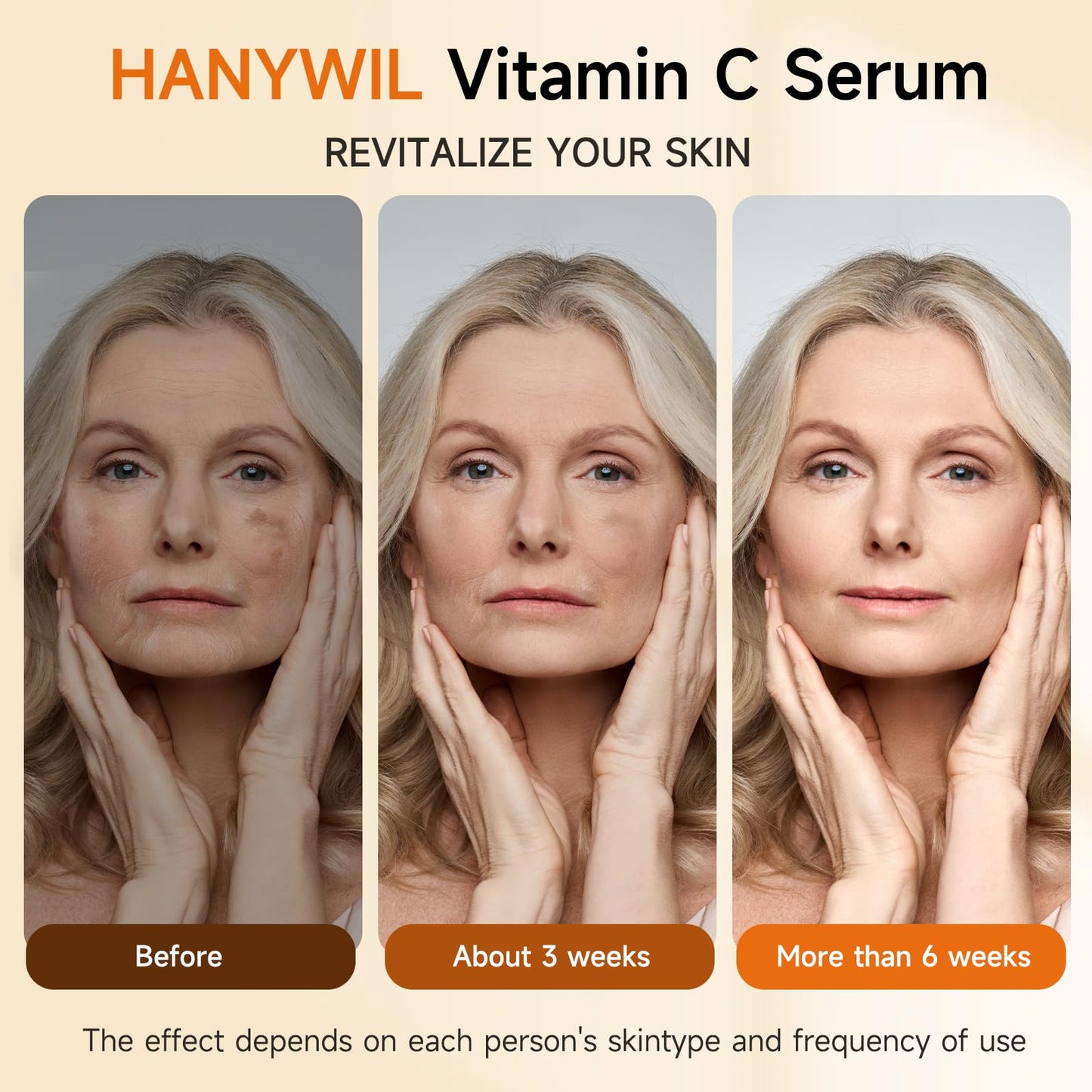 HANYWIL Super Vitamin C Serum for Women over 70, Vitamin C Serum for Face, Dark Spot Remover for Face, Hyaluronic Acid Skin Care, Targets Age Spots